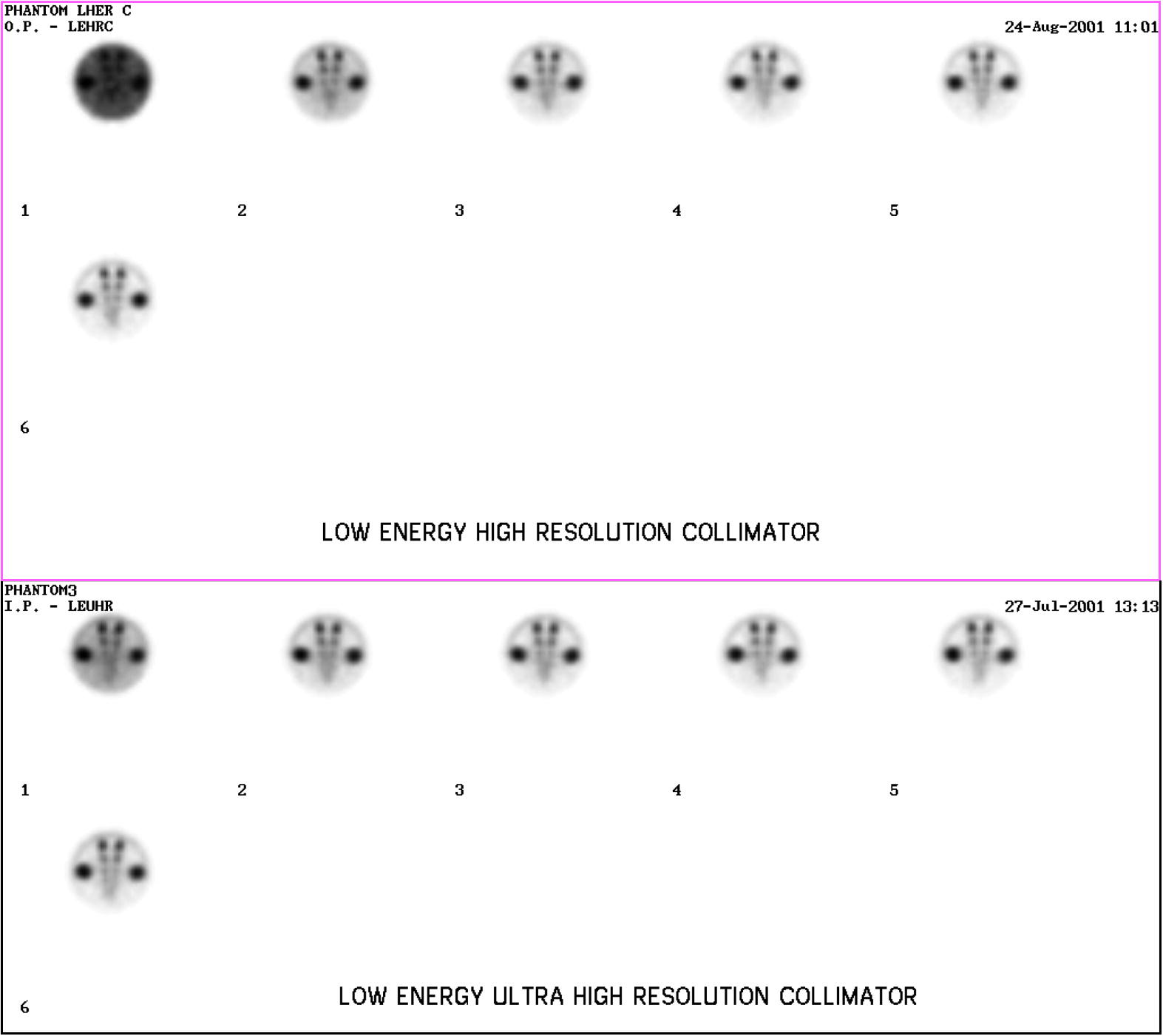 Application Of Single Photon Emission Computed Tomography Spect