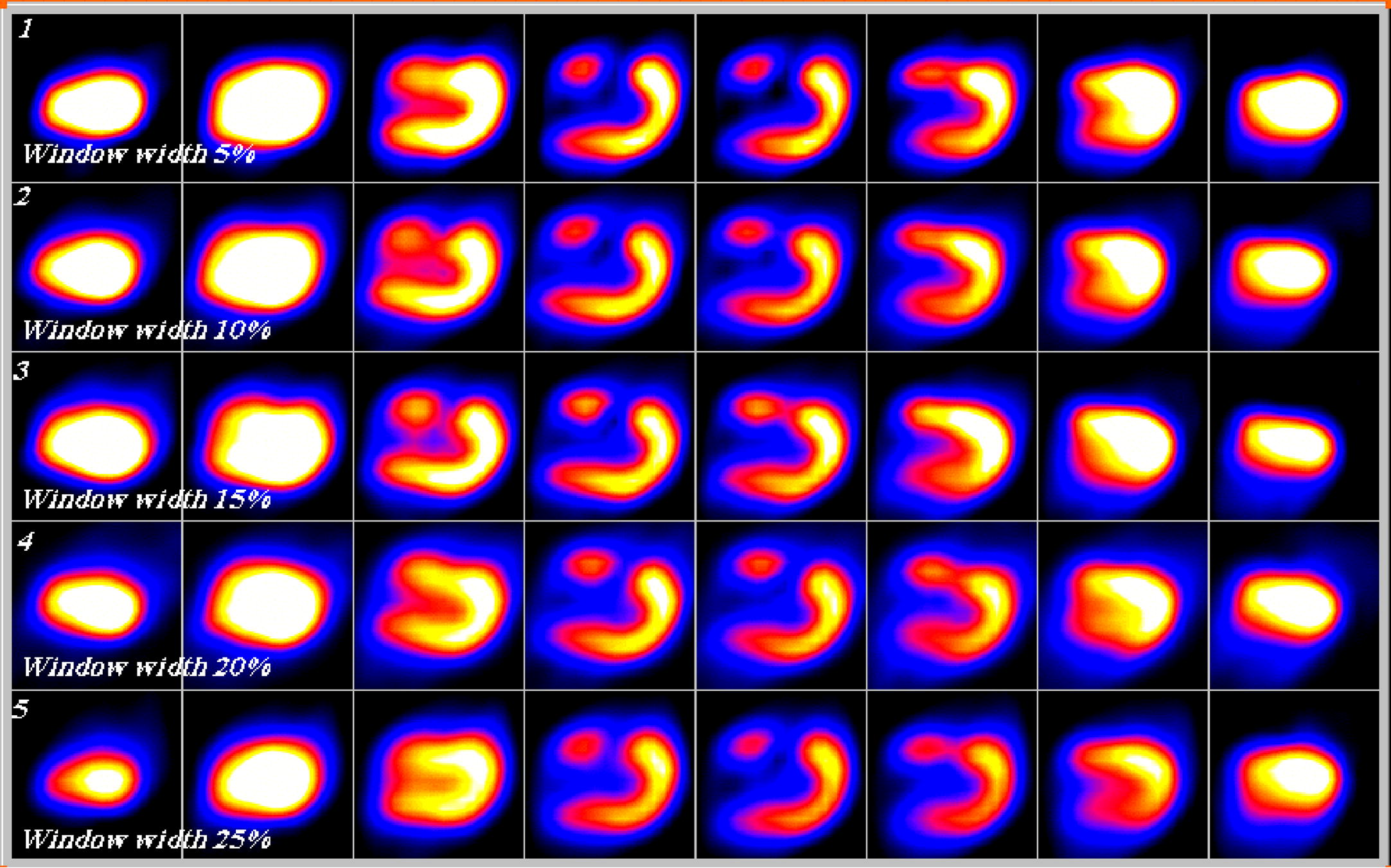 Five rows (1–5) of vertical long axis cuts of a heart phantom SPECT at window widths of energy 5%, 10%, 15%, 20% and 25%, and 0% off-peak shift.