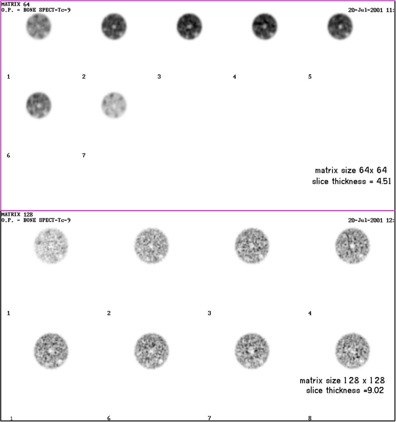 Transaxial image reconstruction of a cylindrical phantom filled with 99 mTc using different matrix sizes.