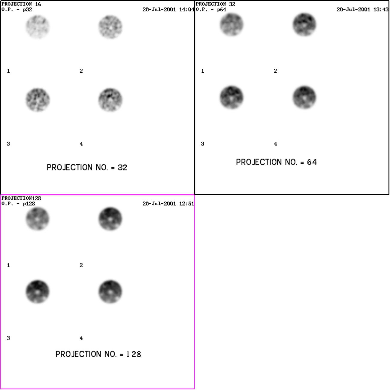 Transaxial image reconstruction of a cylindrical phantom filled with Tc-99 m with different projection numbers.