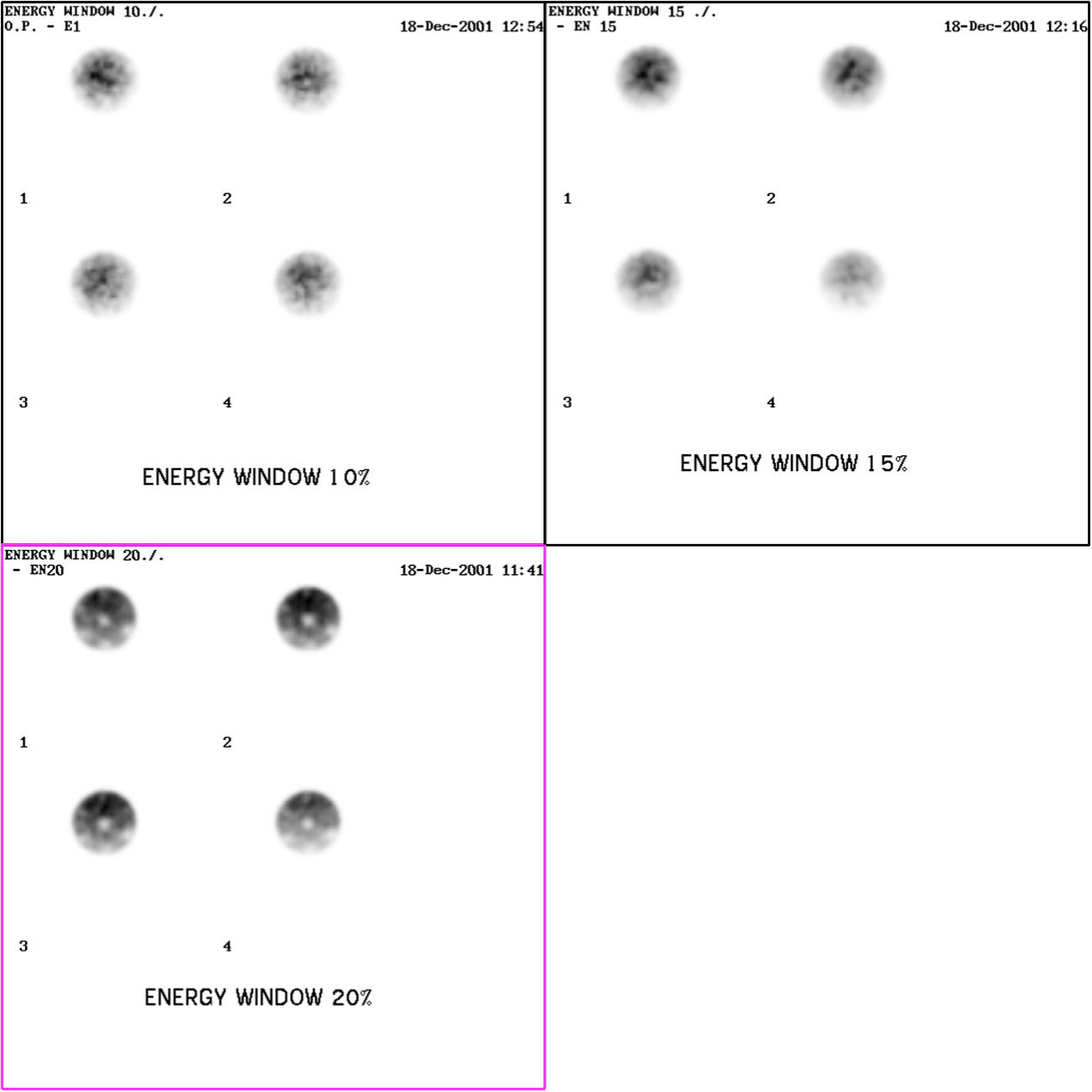 Transaxial image reconstruction of a cylindrical phantom filled with Tc-99 m with different energy window 10%, 15%, and 20% of the photo-peak energy.