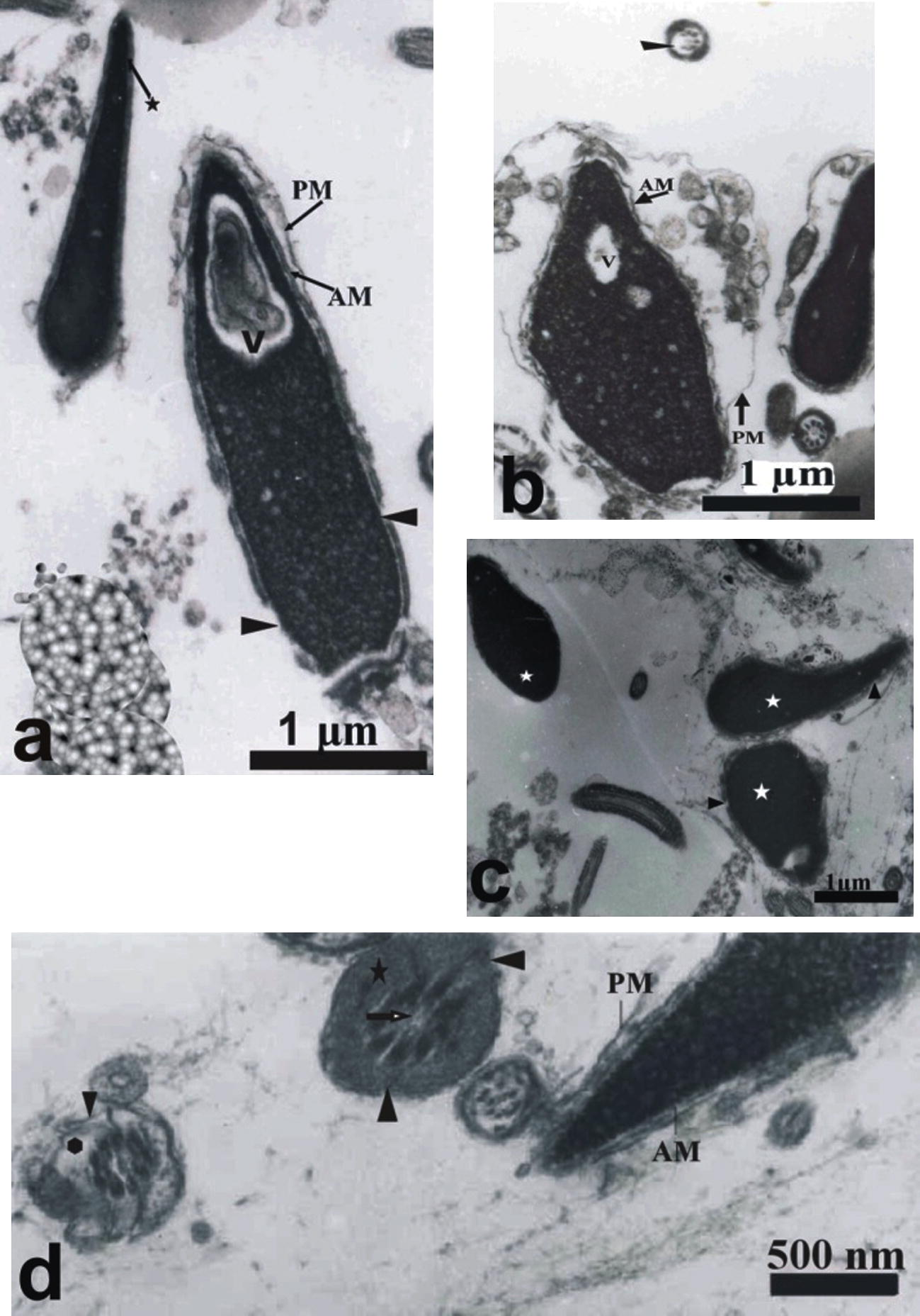 Transmission electron micrographs of frozen–thawed human spermatozoa stored at −20 °C for 2 weeks in 271 or 800 mOsml KSOMaa medium. (a) Normal sperm with intact plasma membranes (star) and sperm with vacuolated nucleus (V) with swelled plasma membrane (PL) and disrupted acrosomal membrane (AM) (head arrow). (b) Spermatozoa with disrupted plasma membrane and swollen acrosome. (c) Sperm with condensed chromatin (white star), disrupted membrane (head arrow), complete loss of plasma membrane and outer acrosomal membrane. (d) Sperm with damaged swelled mitochondria (star), loss of mitochondria (polygon) with the absence of central fibres in the middle piece.