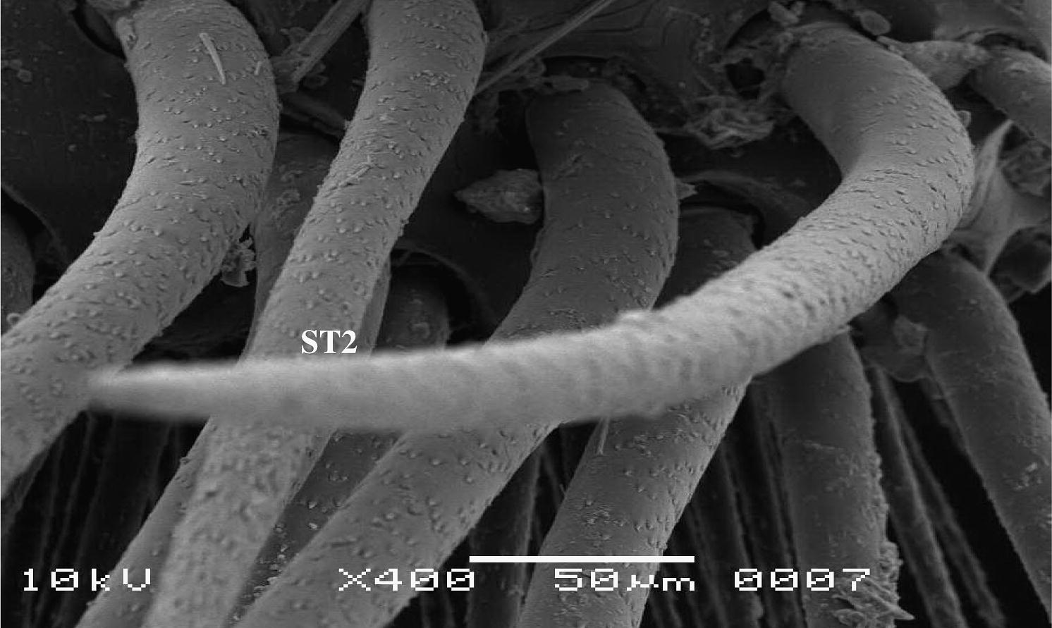 Scanning electron micrograph showing sensilla trichodea articulated ST2.