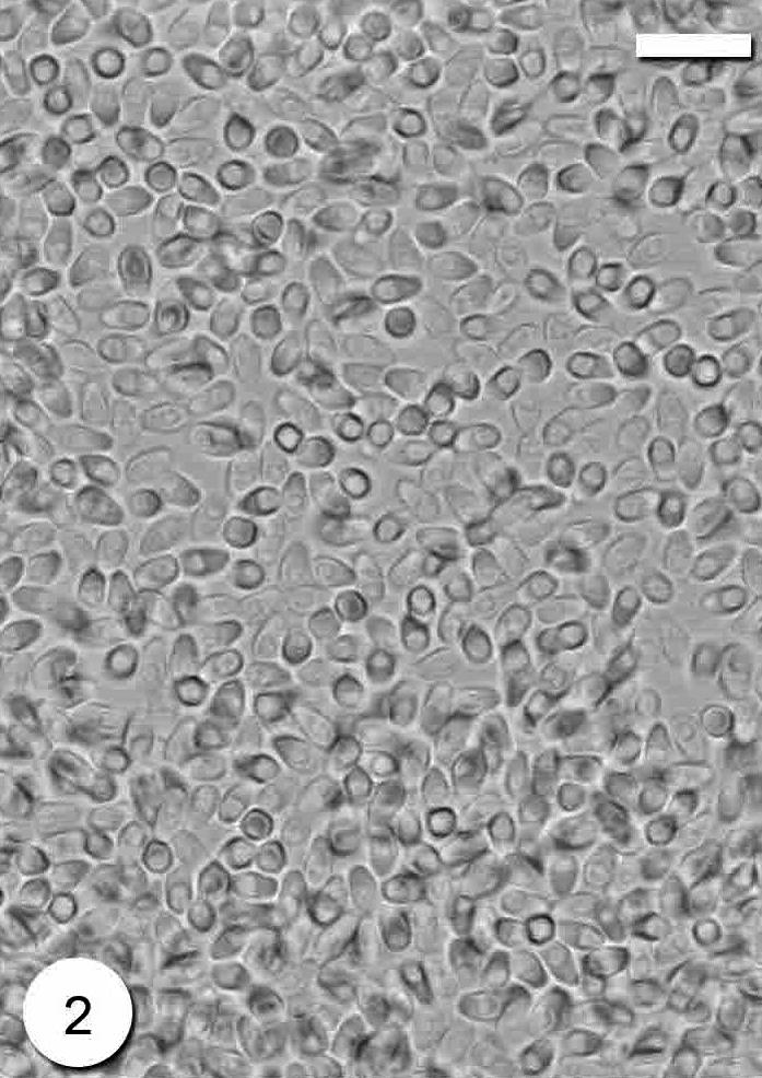 Photomicrograph of Microsporidium sp. fresh spores. Scale-bar = 10 μm.