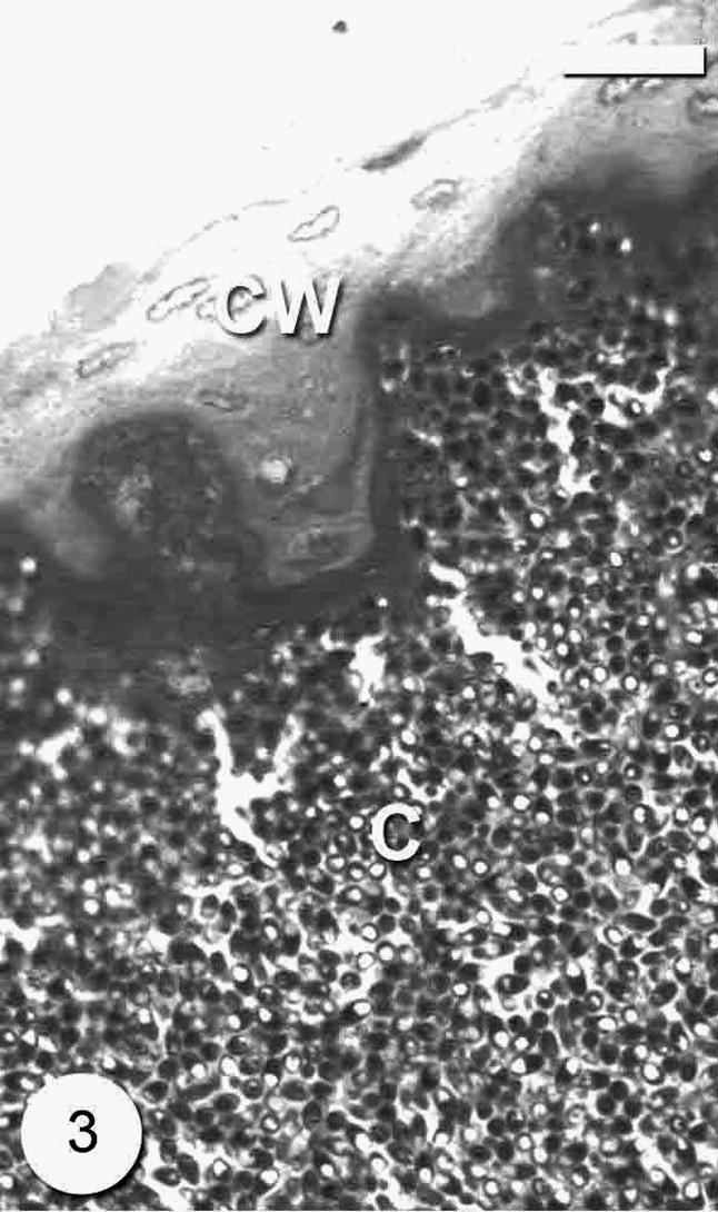 Photomicrograph of semi-thin section through the Microsporidium sp. cyst (C) surrounded with thick cyst wall (CW). Bar = 10 μm.