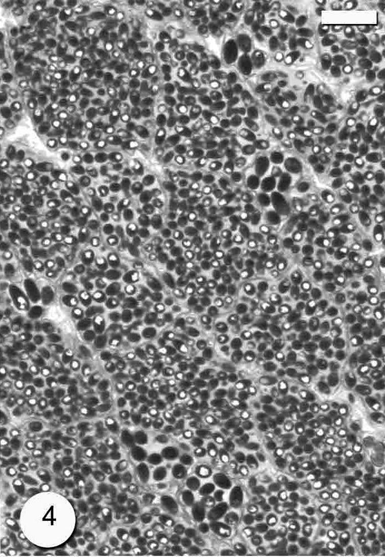 Photomicrograph of semi-thin section through the Microsporidium sp. cyst which divided by many septa (arrows). Bar = 10 μm.