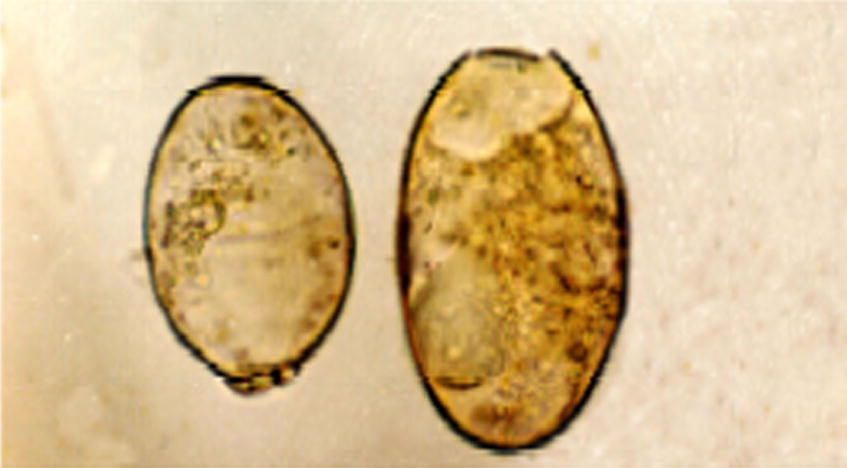 Photomicrograph of different eggs size from the same fluke 100×.