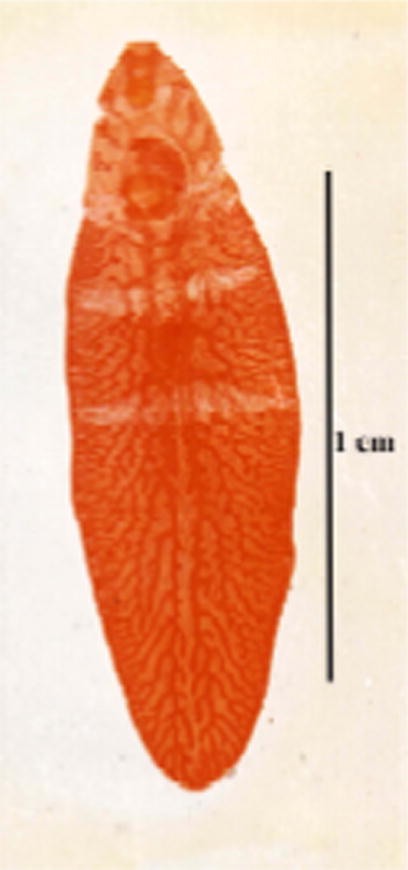 Photomicrograph of the immature worm of new strain of F. hepatica.