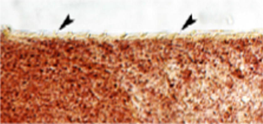 Photomicrograph of fine spines (arrowheads) on the cephalic cone of F. hepatica (new strain) 100×.