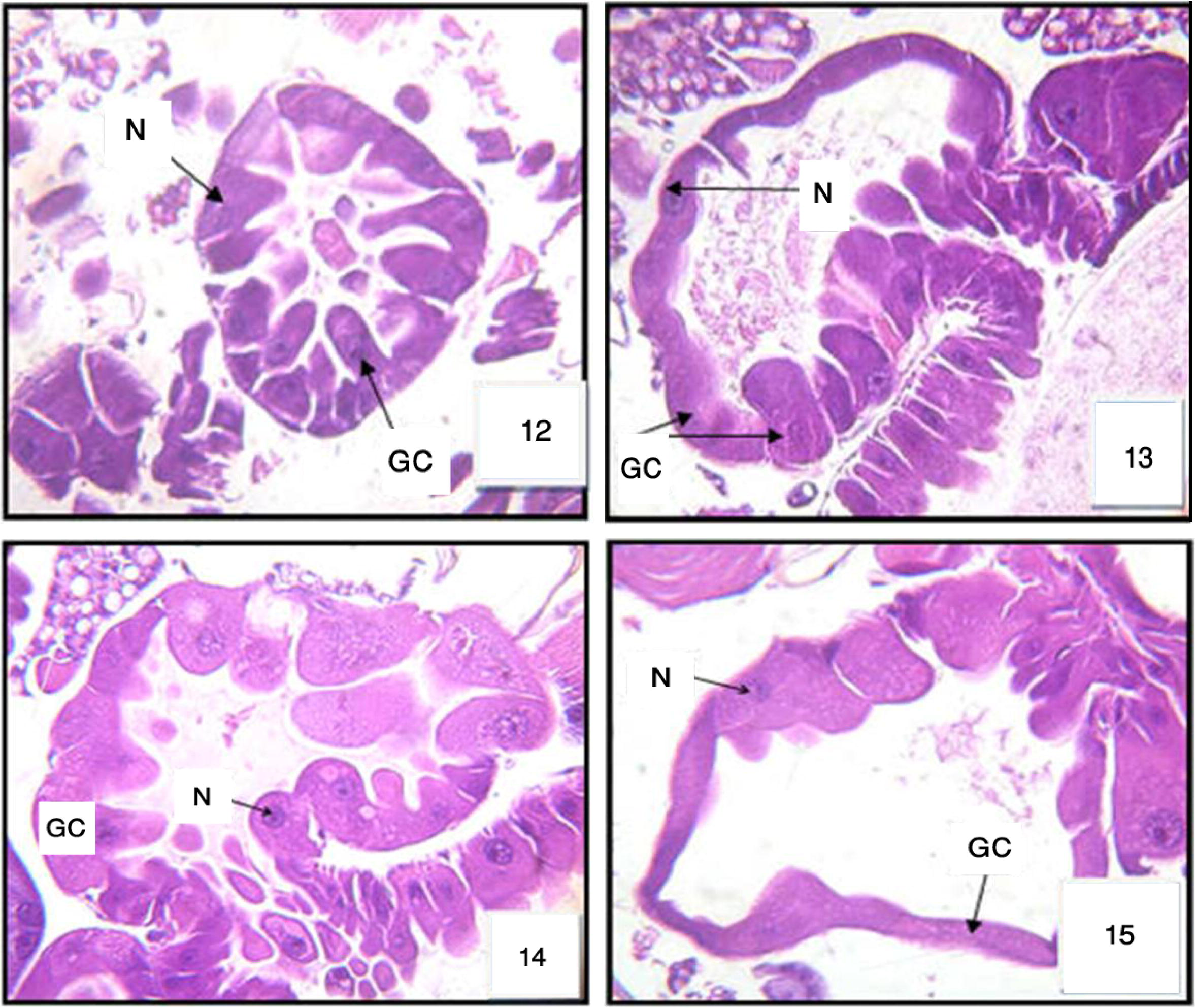 Cross section in gastric caeca (GC) of 3rd larval instar of Cx. quinquefasciatus treated with LC50 of M. azedarach after 6 h, after 12 h: Fig. 13, after 24 h: Fig. 14, and after 48 h: Fig. 15). Nucleus (N). 400×.