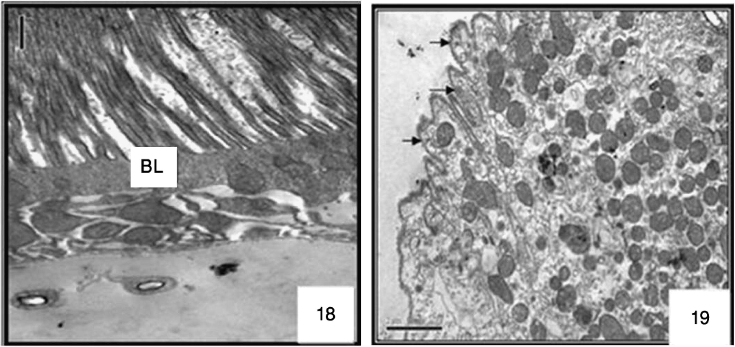 Ultrastructure of cells at 24 h after M. azedarach treatment larvae of Cx. quinquefasciatus. Transmission electron micrograph, destroyed MICROVILLI ARROW. 4000×.