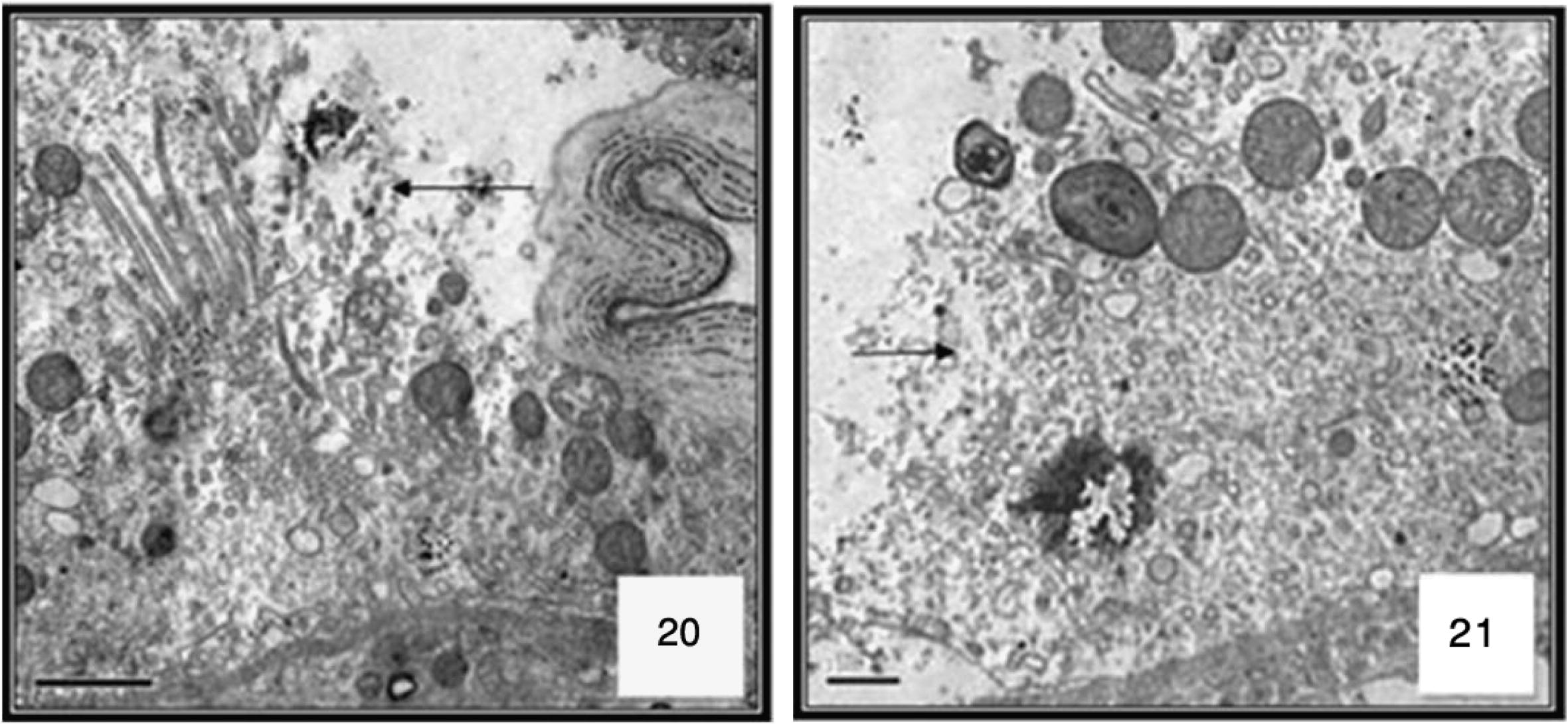 Ultrastructure of cells at 48 h after M. azedarach treatment larvae of Cx. quinquefasciatus. Transmission electron micrograph. 4000×. Cell disruption arrow.