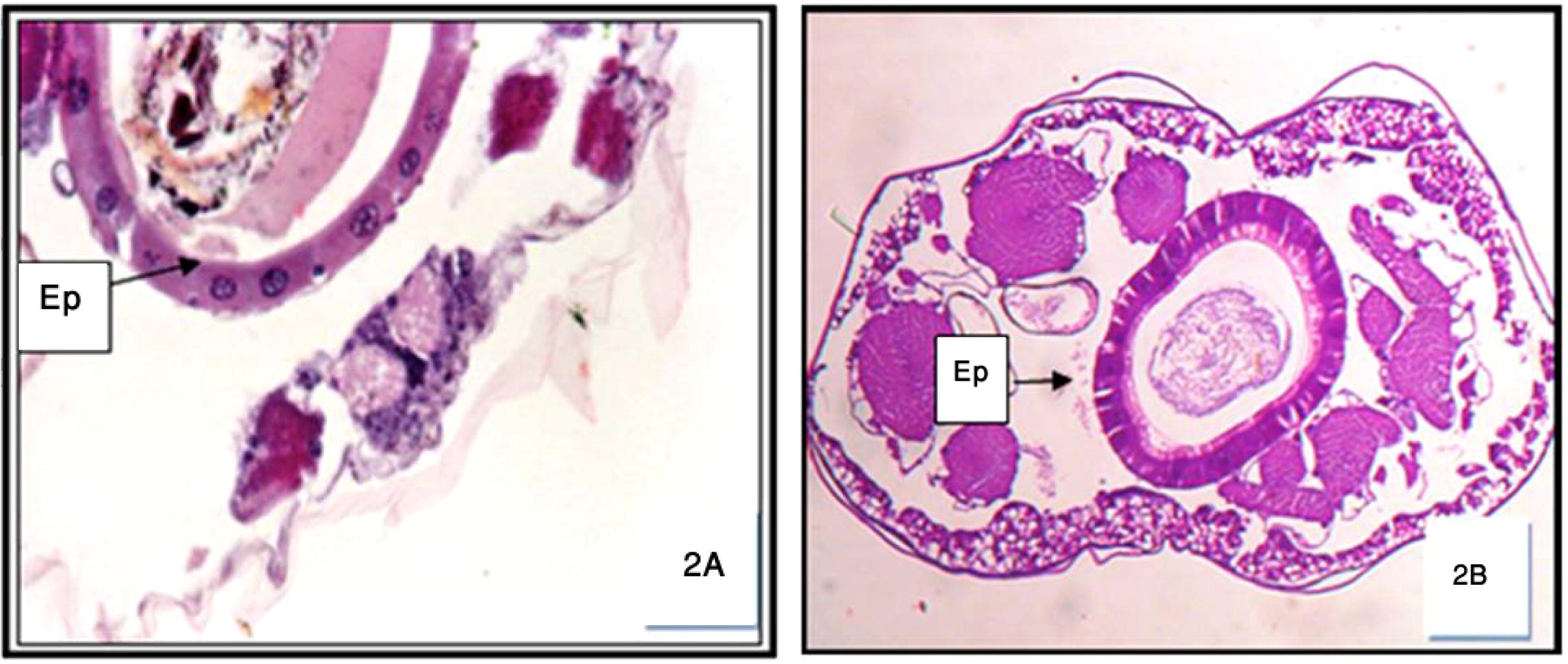 Cross-section in the anterior (A) and posterior (B) regions of normal untreated Cx. quinquefasciatus 3rd instar larva showing the foregut-epithelia cells (Ep.). 200×.