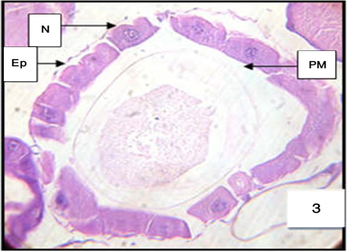 Anterior midgut of 3rd instar larvae of Cx. quinquefasciatus treated with LC50 of M. azedarach extract, showing the effect after 6 h of exposure. Epithelial cells (EP), peritrophic membrane (PM) and nucleus (N). 400×.