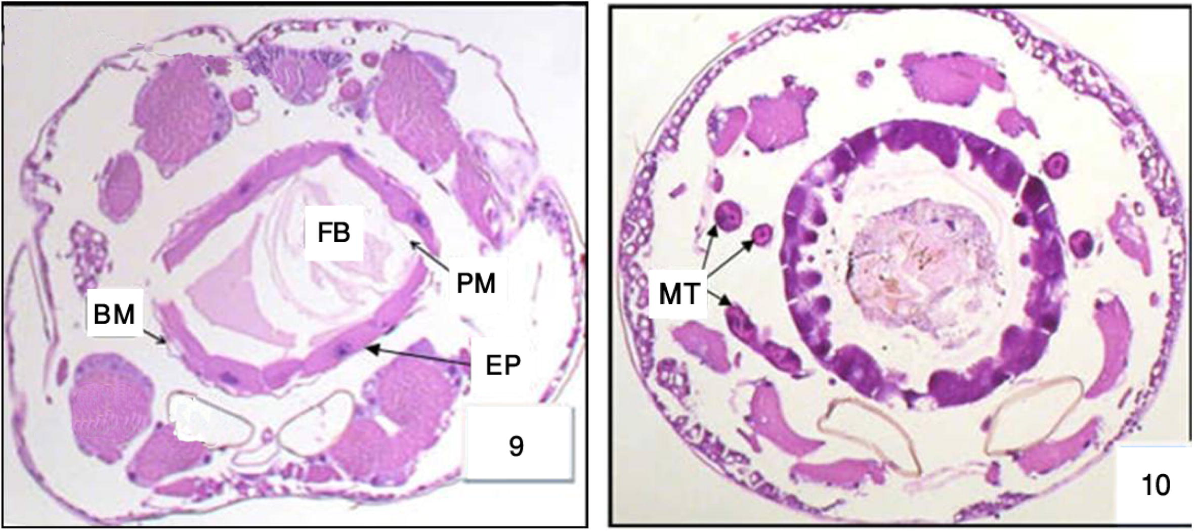 Cross section in the anterior and posterior regions of midgut in 3rd Cx. quinquefasciatus larval instar treated with LC50 of M. azedarach extract, showing the effect after 48 h of exposure. Epithelial cells (EP), peritrophic membrane (PM), food bolous (FB), malpighian tubules (MT) and basement membrane (BM). 400×.