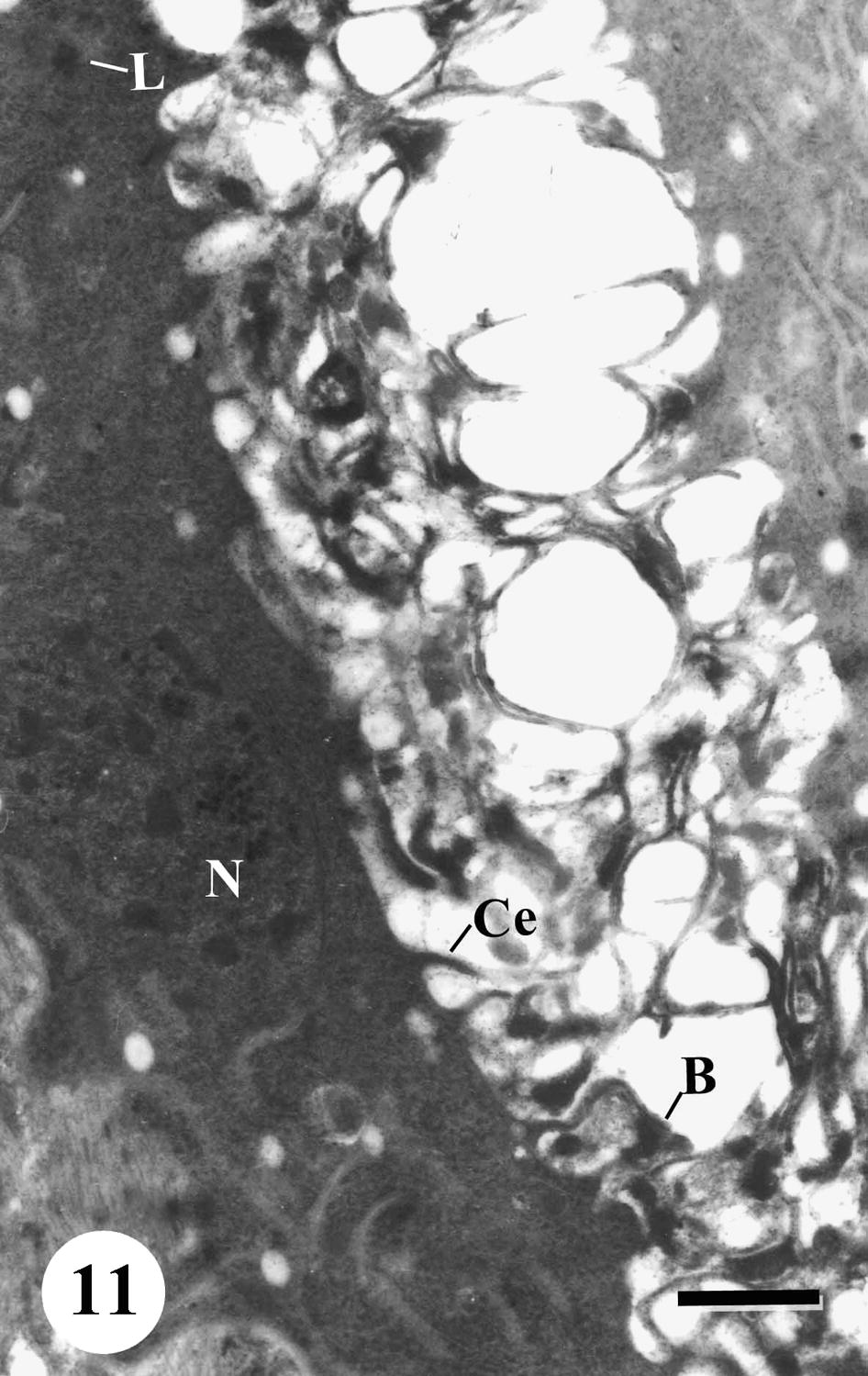 TEM of gastrodermis of adult male Schistosoma mansoni recovered from mice treated with Sidr honey and black-seed oil showing disorganized gastrodermis containing lipid droplets (L) and blebbing (B) of small components from the apical surface. Note extensively decreased cytoplasmic extensions (Ce). Bar = 1 μm.