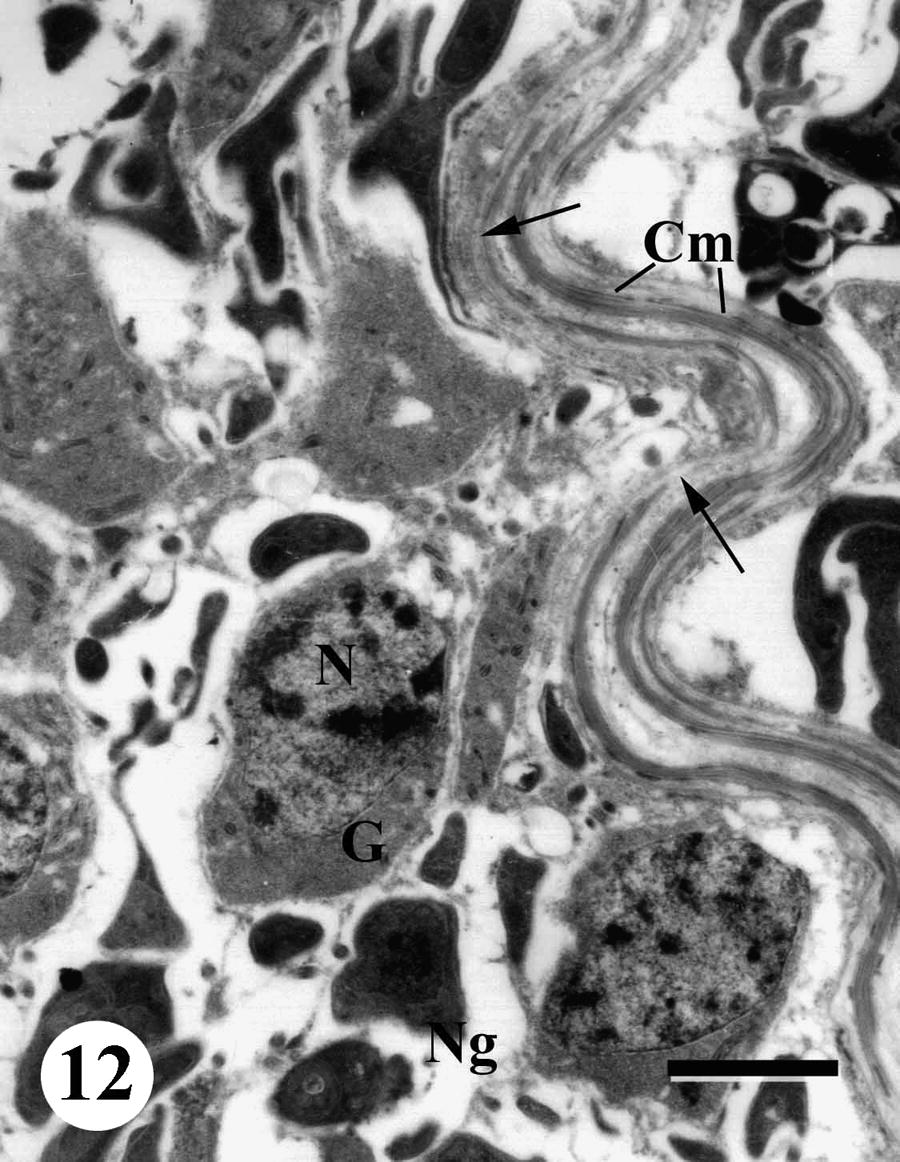 TEM of a testis of adult male Schistosoma mansoni recovered from infected, non-treated mice showing germinal cells (G), non-germinal cells (Ng), nucleus (N), nucleolus (Nu), basal lamina (arrows) and circular muscle (Cm). Bar = 2 μm.