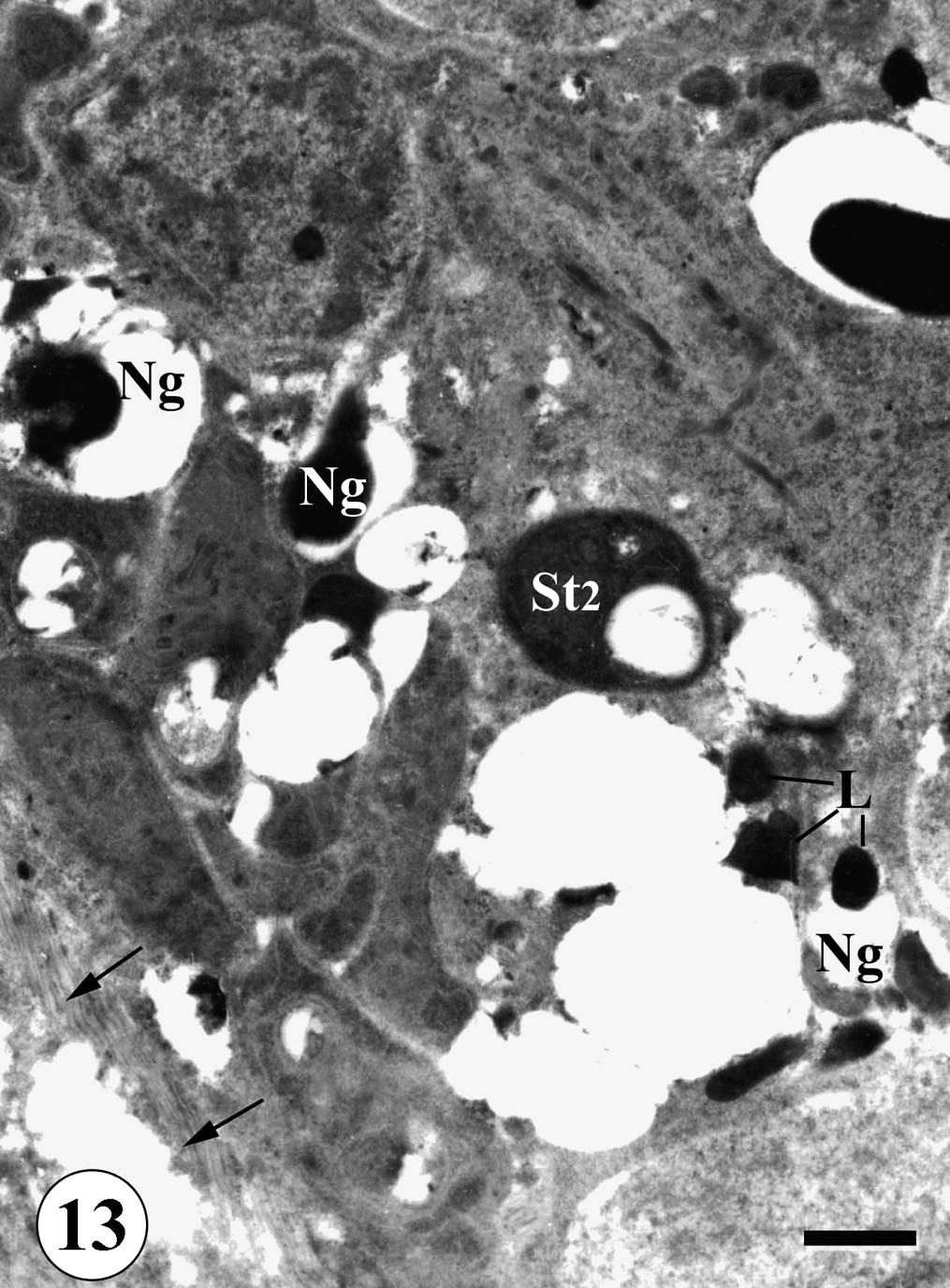 TEM of testis of adult male Schistosoma mansoni recovered from mice treated with Sidr honey and black-seed oil showing degeneration of non-germinal cells (Ng), aggregation of lipid granules (L). Note also disruption of follicular wall (arrows). Bar = 2 μm.