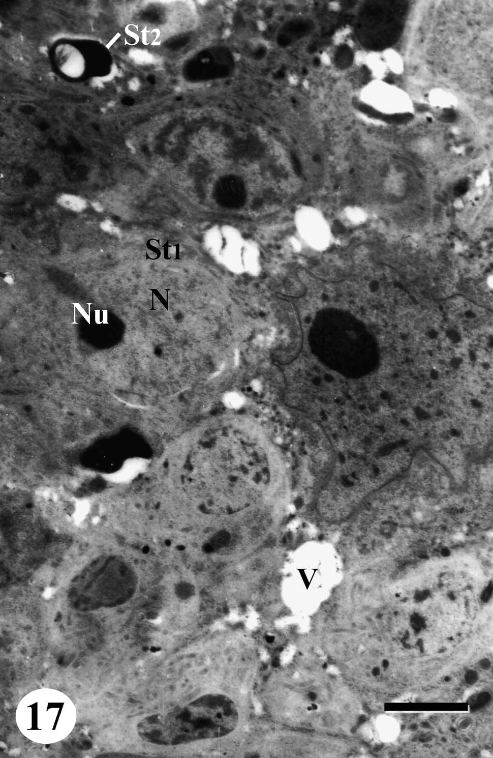 TEM of testis of adult male Schistosoma mansoni recovered from mice treated with Sidr honey and black-seed oil showing rosette of early spermatids (St1), with pale cytoplasm containing numerous mitochondria, pale swollen nucleus (N) with nucleolus (Nu) and few chromatin patches. Note degenerated late spermatid (St2). Bar = 2 μm.