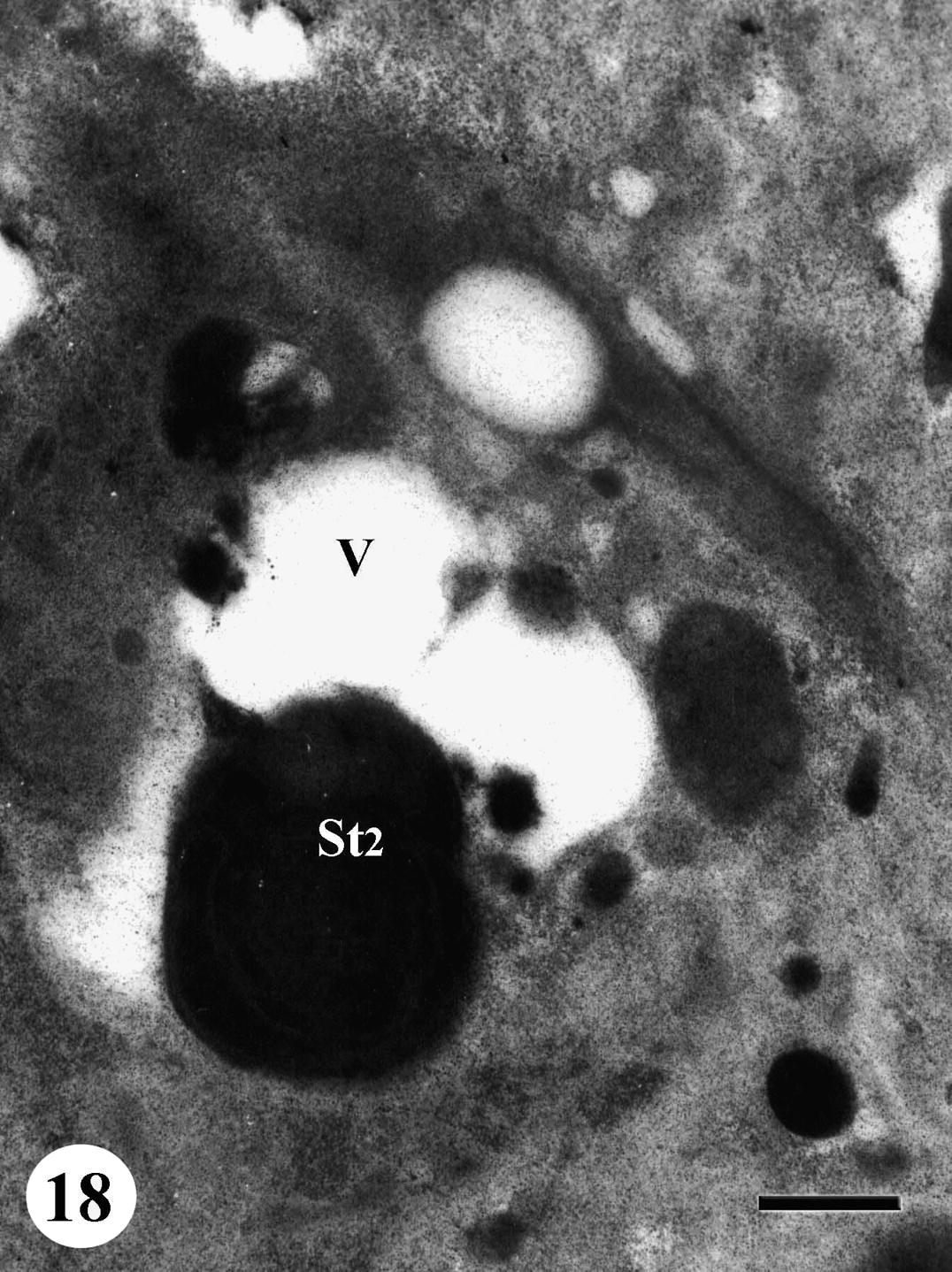 TEM of testis of adult male Schistosoma mansoni recovered from mice treated with Sidr honey and black-seed oil showing regressed late spermatid (St2). Note a pronounced vacuolation (V) of testicular material. Bar = 500 nm.