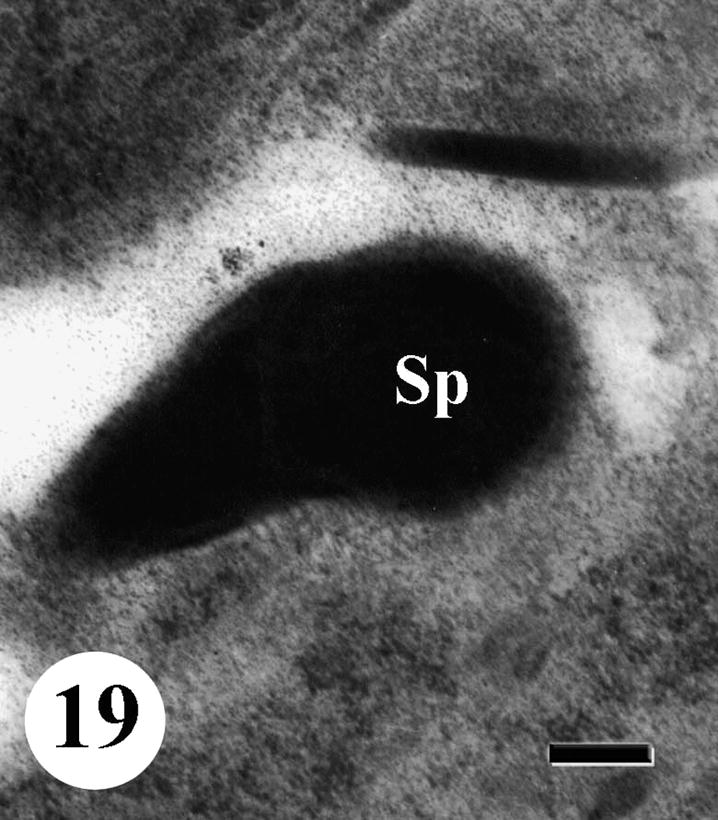 TEM of testis of adult male Schistosoma mansoni recovered from mice treated with Sidr honey and black-seed oil showing spermatozoa (Sp) with abnormal morphology and nucleus lost characteristic electron-lucent area. Bar = 200 nm.