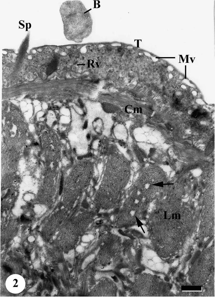 TEM of the tegumental surface of adult male Schistosoma mansoni recovered from infected mice treated with Sidr honey showing blebs (B) on the outer surface of the tegument, numerous membrane bound vesicles (Mv) under outer tegumental surface (T) and rod shaped vesicles (Rv). Note swelling of circular (Cm) and longitudinal (Lm) muscle layers. Some muscle bands riddled with many vacuoles (arrows). Bar = 1 μm.