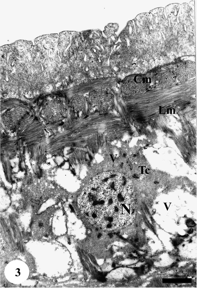 TEM of the ventral side of tegumental surface of adult male Schistosoma mansoni recovered from infected mice treated with Sidr honey. The tegumental cells (Tc) showed tremendous vacuolation (V) in cytoplasm and nuclear material (N). The muscle layers (Cm and Lm) appear normal. Bar = 1 μm.