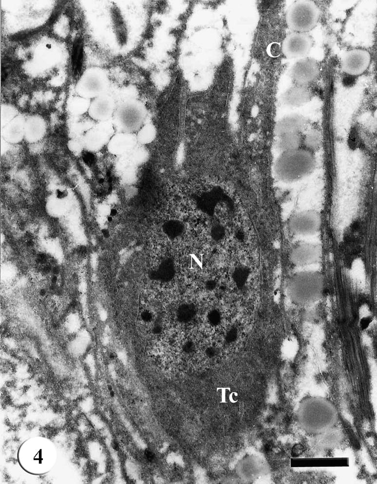 TEM of the tegumental cell (Tc) of adult male Schistosoma mansoni recovered from infected mice treated with Sidr honey showing cytoplasm with decreased secretory granules, nucleus (N) and connecting canal (C). Bar = 1 μm.