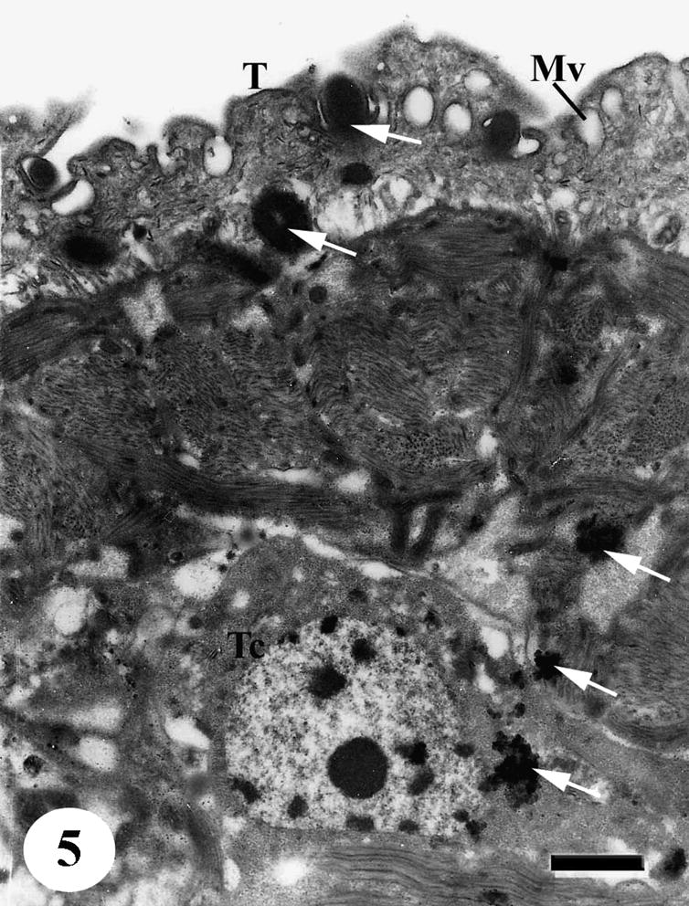 TEM of the ventral tegumental surface of adult male Schistosoma mansoni recovered from infected mice treated with black-seed oil showing distorted tegumental cell with vacuolated cytoplasm while aggregation of dark secretory granules (arrows) appeared in cytoplasm, connecting canal and in outer tegumental layer (T). Note the presence of numerous membrane bound vesicles (Mv). Bar = 1 μm.