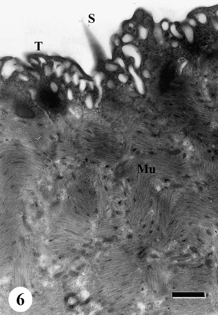 TEM of the tegumental surface of adult male Schistosoma mansoni recovered from infected mice treated with Sidr honey and black-seed oil showing tremendously vacuolated outer tegumental layer (T) with numerous membrane bound vesicles (Mv) and swelling of the muscle layer (Mu). Bar = 1 μm.