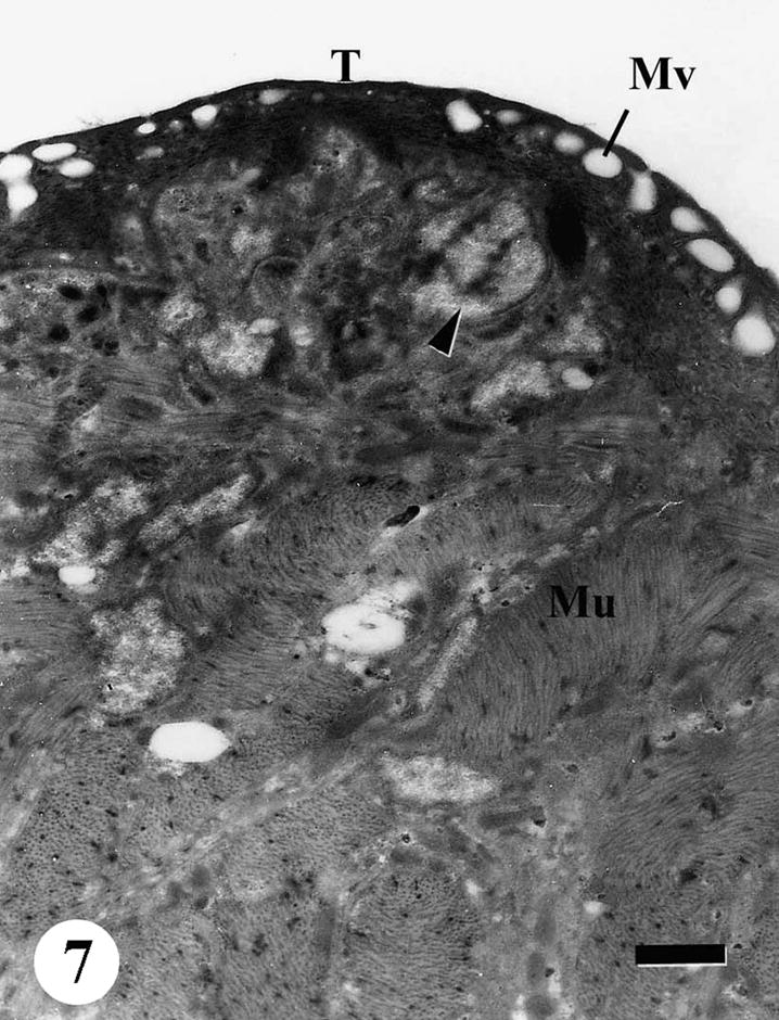 TEM of the tegumental surface of adult male Schistosoma mansoni recovered from infected mice treated with Sidr honey and black-seed oil, spines completely disappeared, membrane bound vesicles (Mv) in the outer tegumental layer (T), abnormal loose material (arrowhead), swelling of the muscle layer (Mu). Bar = 1 μm.