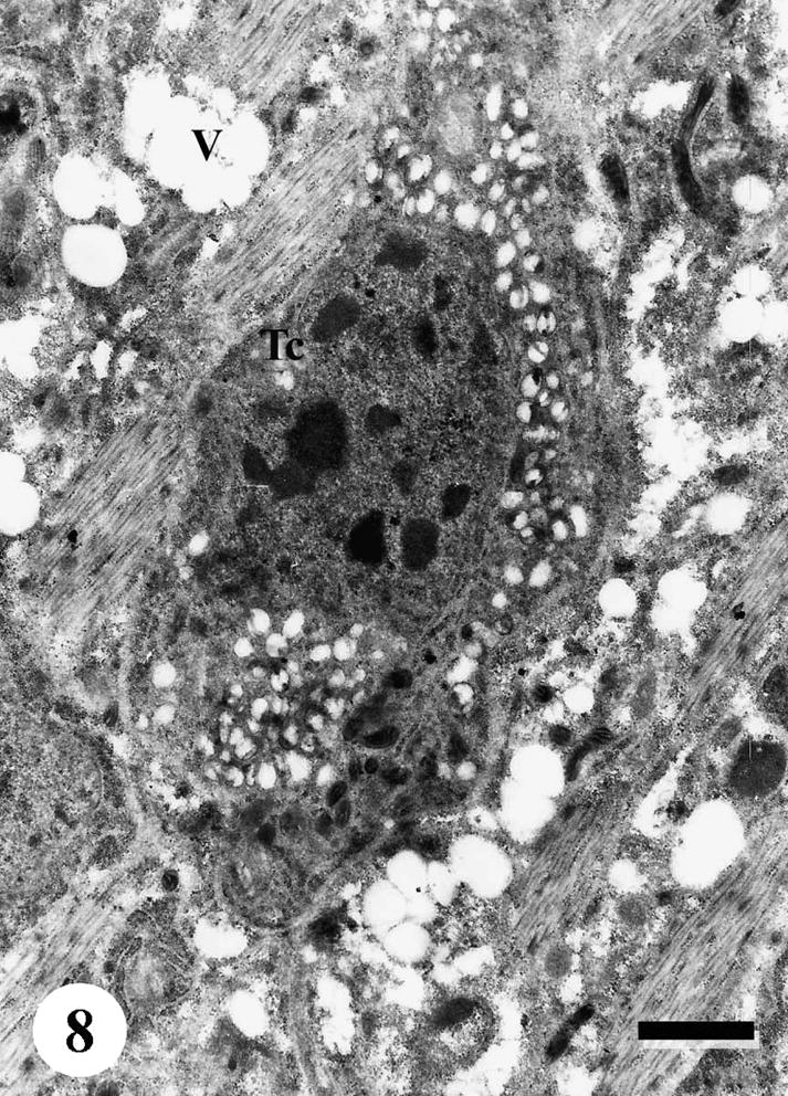 TEM of the subtegumental area of adult male Schistosoma mansoni recovered from infected mice treated with Sidr honey and black-seed oil, showing distortion of the tegumental cells (Tc), with highly vacuolated cytoplasm. Vacuolation spreads everywhere in subtegumental tissue and between muscle bundles (V). Bar = 1 μm.