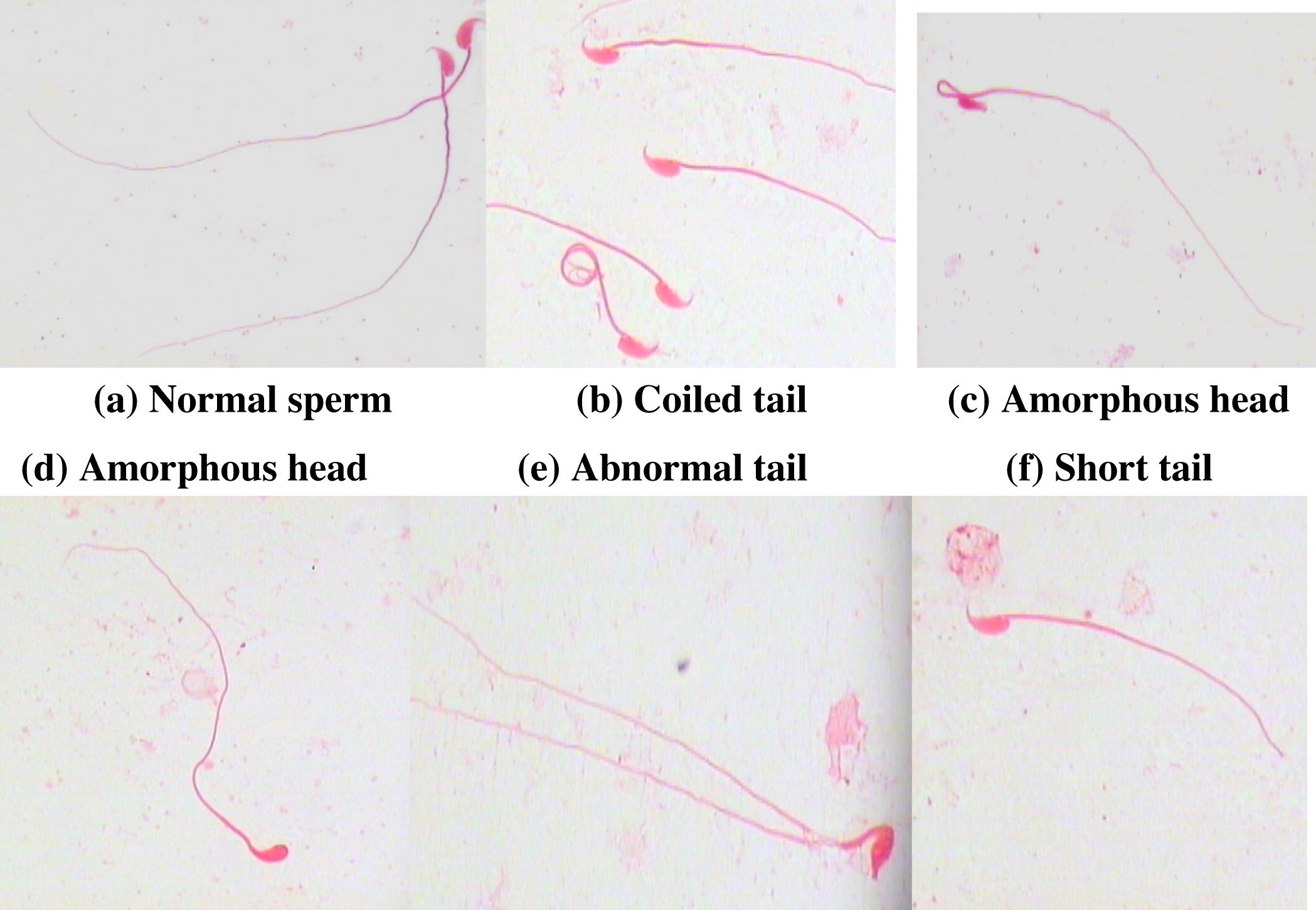 Effect of gamma rays on the frequencies of sperm head and tail abnormalities in different groups of mice, assessed at 0, 6, 24, and 72 h.