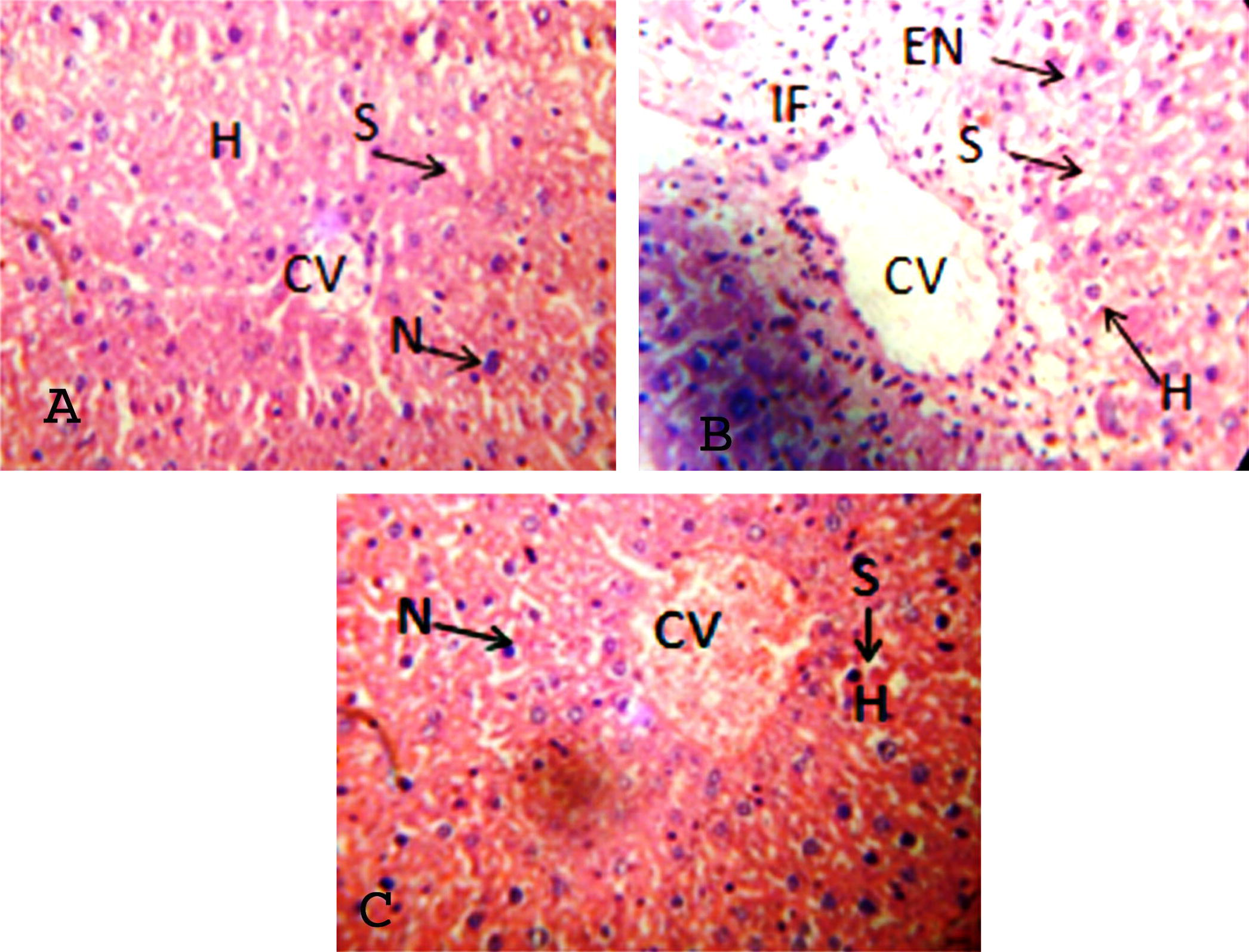 (A) Control histology liver showed intact hepatocytes (H), prominent nucleus (N), sinusoidal space (S) and central vein (CV). (B) Alloxan induced rats showed damage deformation in central vein, enlargement of nucleus (EN), infiltration of cells (IF), degeneration and loss of cell boundaries. Well developed hepatocyte with prominent nucleus and maintained sinusoidal space after Crinum asiaticum (C) treatment.