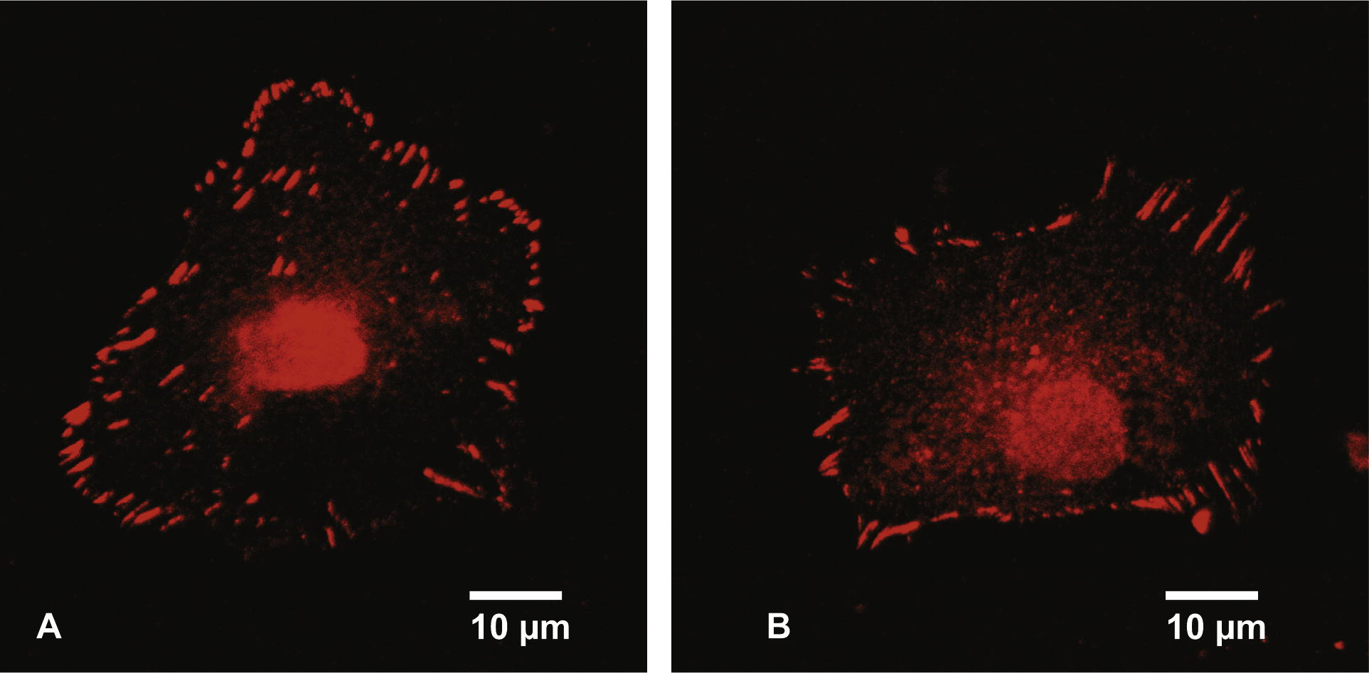 Fluorescence microscope picture of a cell grown in the absence of SWCNT (A). The focal adhesion points were stained with a fluorescent dye conjugated to vinculin. Fluorescent microscope picture of a cell grown for 5 days in the presence of 30 μg/ml SWCNT raw material (B). The focal adhesion points were stained with a fluorescent dye conjugated to vinculin.