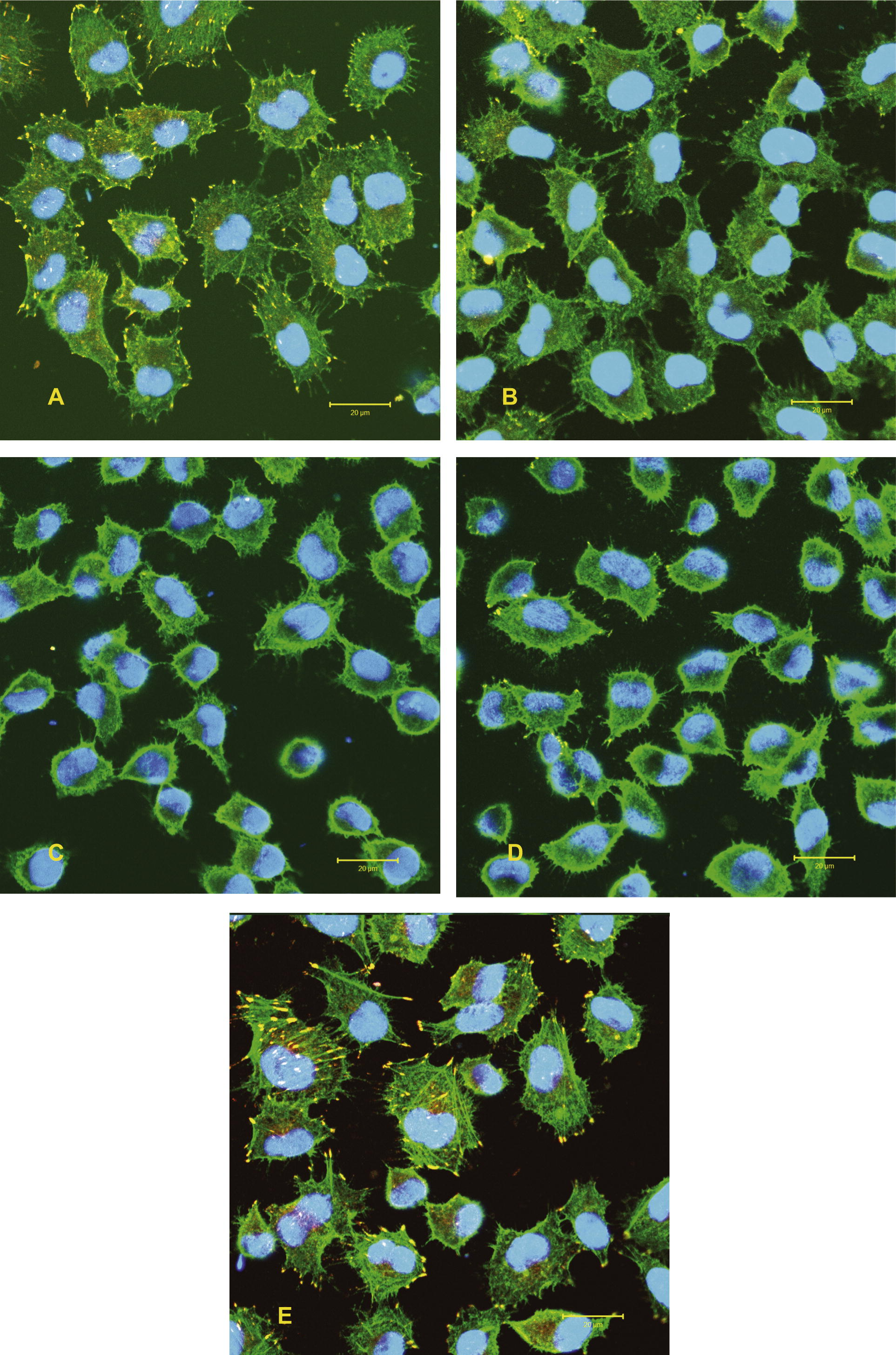 Spreading behaviour (cytoskeleton organization) of epithelial cells exposed to 15 μg/ml and 30 μg/ml SWCNT bundles and SWCNT raw material for 5 days. Staining: actin filaments (green), vinculin (yellow) and nucleus (blue). A = SWCNT bundles (15 μg/ml), B = SWCNT bundles (30 μg/ml), C = SWCNT raw material (15 μg/ml), D = SWCNT raw material (30 μg/ml), E = Control.(For interpretation of the references to colour in this figure legend, the reader is referred to the web version of this article.)