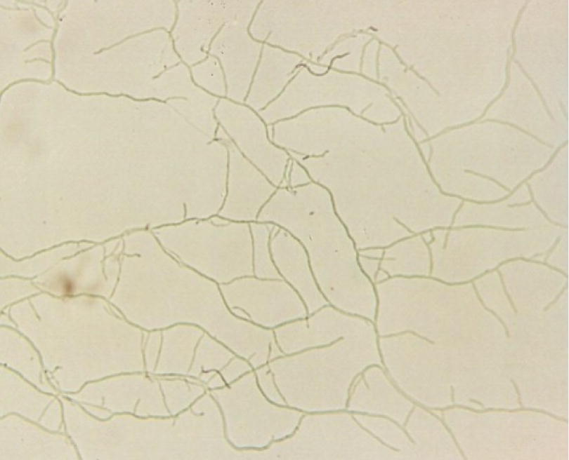 Microscopic view of St-1 (S. griseorubens).