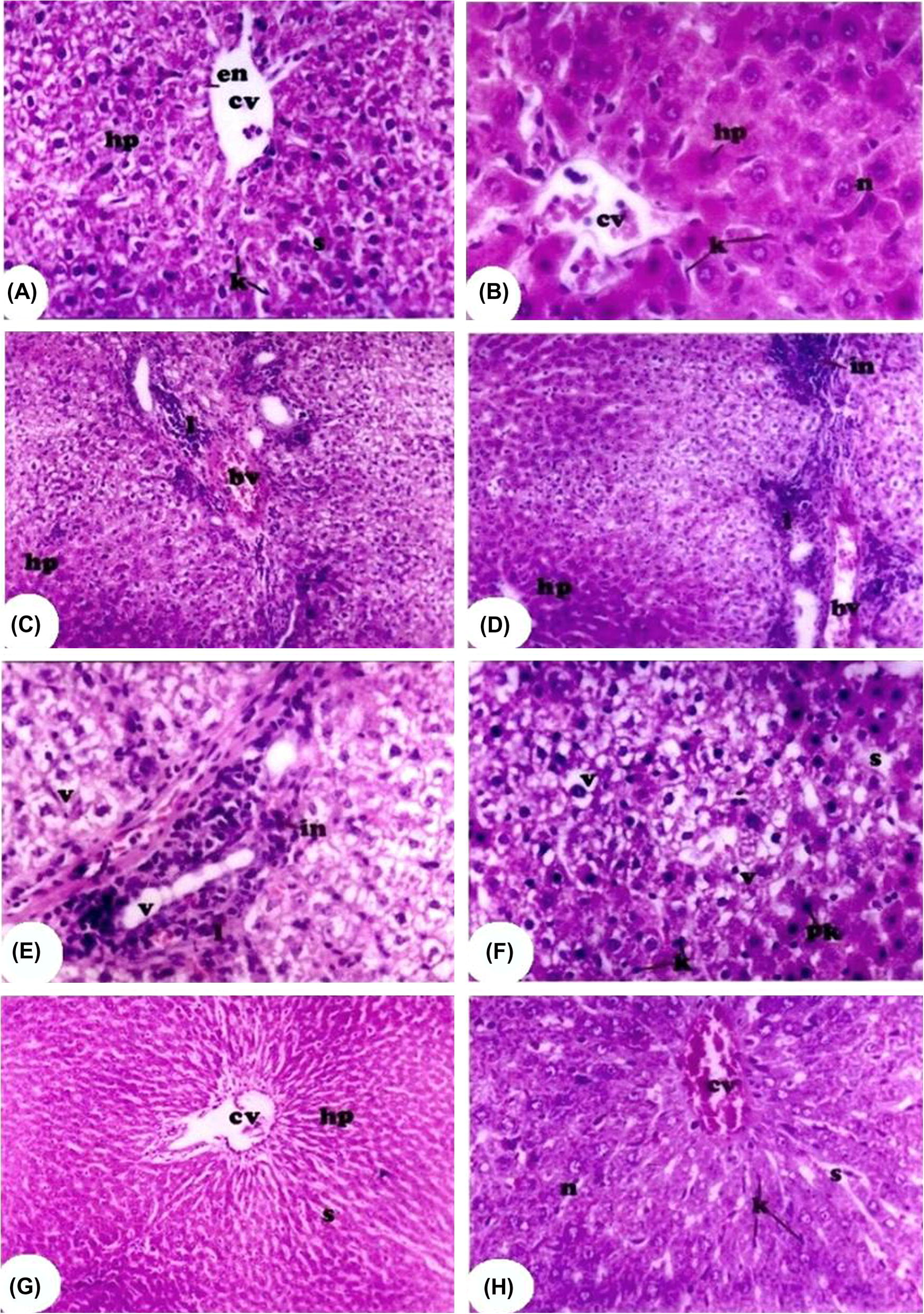 Hematoxylin and Eosin (H&E) photomicrograph of the liver sections from all rat groups. (A and B) Represent photomicrograph from the control and control + vitamin E-treated groups, respectively, showing a well-preserved liver architecture central with central vein (cv) lined with endothelial cells (en), hepatic cells (hp) with centrally located nuclei (n), Kupffer cells (k), and narrow blood sinusoids (s). (C–F) Represent photomicrograph from Cr-treated rat displaying congested blood vessels (bv) and increased lymphocytic infiltration (l, in) and the distortion of hepatic cells (HP). Pyknotic nuclei (pk), increased Kupffer cells (k), and numerous vacuoles (v) and sinusoids (s) were also seen. (G and H) Representative photomicrographs from Cr + vitamin E-treated rats showing great recovery of the hepatocytes (hp). The hepatic cells nearly retain their radial arrangement around the central vein (cv). Numerous sinusoids (s) appeared between the hepatic cells. The presence of some congested blood vessels (CV) and hemorrhage were observed in some samples.