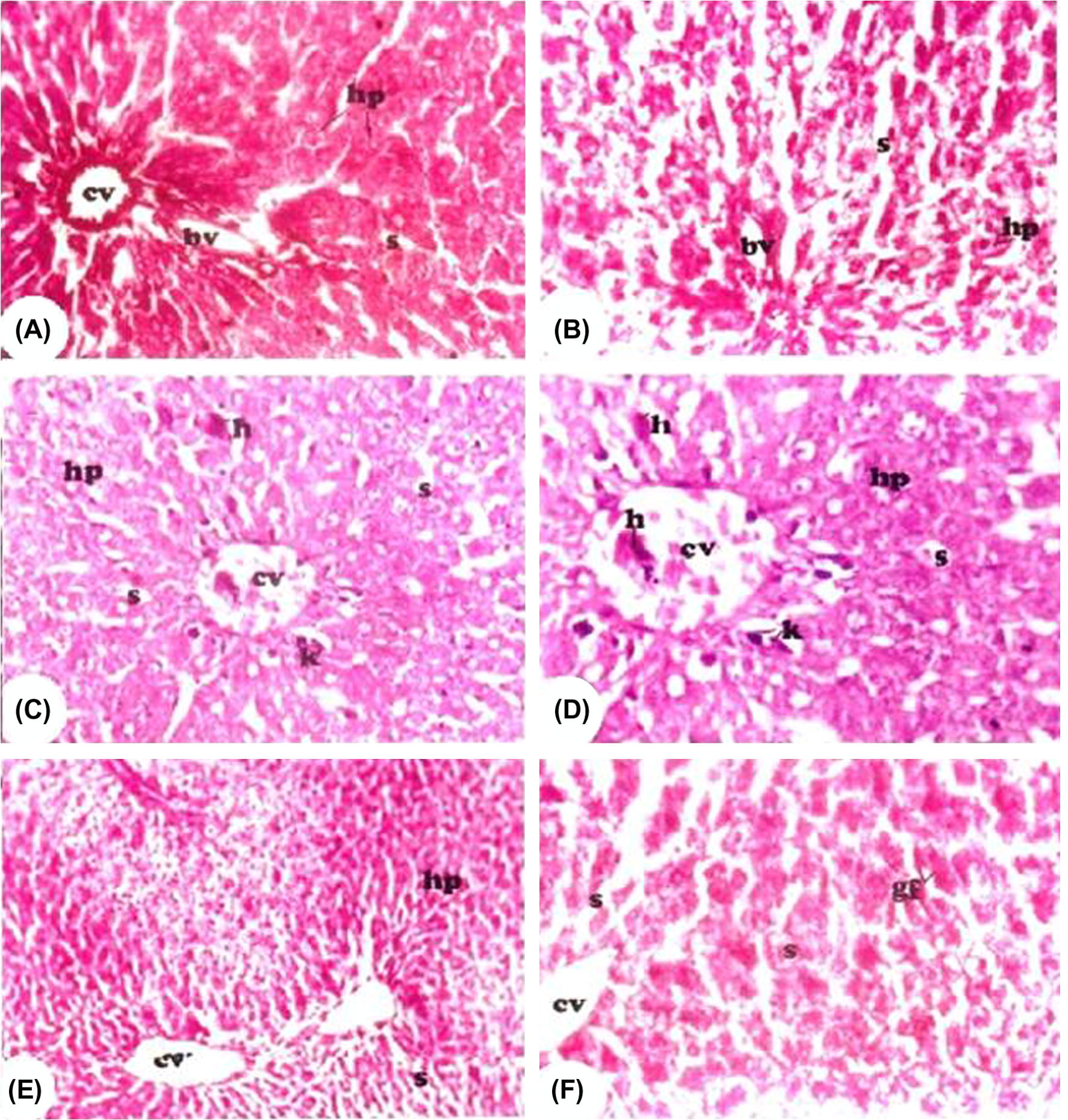 Periodic acid-Schiff (PAS) photomicrograph of the liver sections from all rat groups for detection of glycogen deposition. (A and B) Represent photomicrograph from the control group and control + vitamin E groups, respectively, showing strong PAS-positive materials in the hepatocytes (hp). (C and D) Represent photomicrograph from Cr-treated rats showing marked inhibition of PAS-positive materials in the hepatic cells (hp). Kupffer cells (k), sinusoidal spaces (s), and hemorrhage (h) are abundant. (E and F) Representative photomicrographs from Cr + vitamin E-treated rats showing great recovery of PAS-positive materials in the liver cells. Glycogen flight (gf) and numerous sinusoidal spaces (s) are visible. cv: central vein, bv: blood vessels. Red coloration indicates positive PAS reaction.