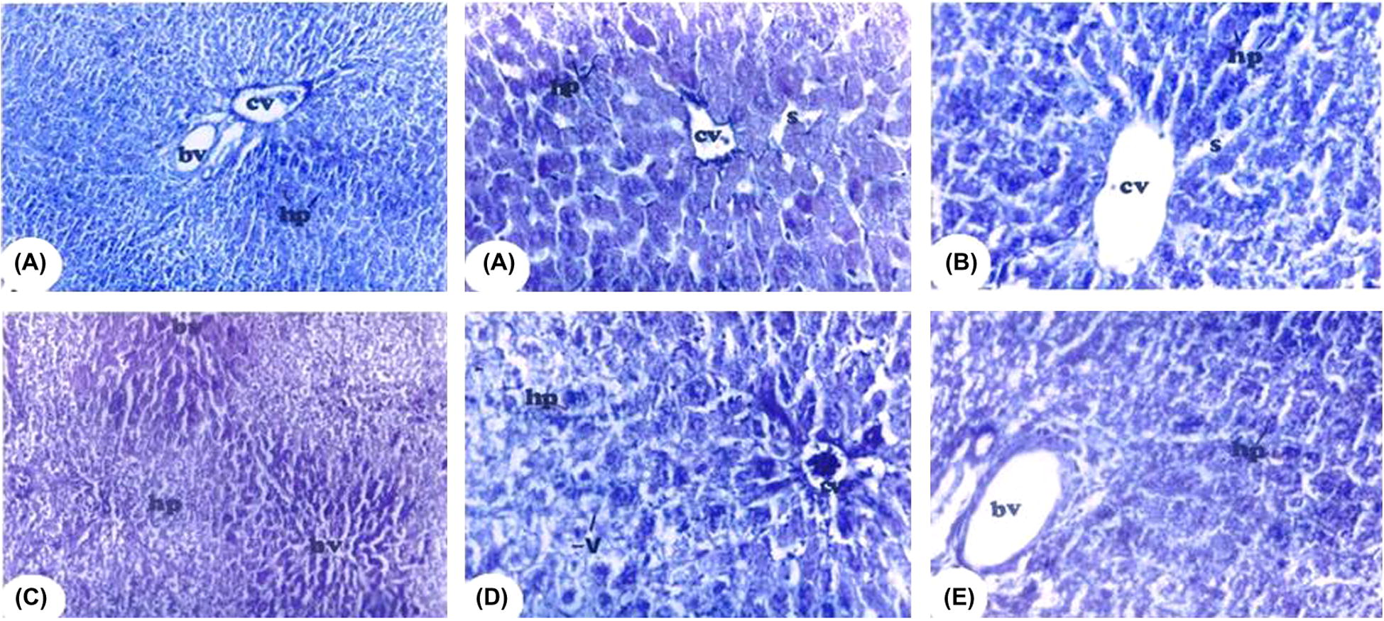 Mercuric bromophenol blue-stained photomicrograph of a liver section from all groups for detection of protein deposition. Blue coloration indicated positive reaction. (A and B) Represent photomicrographs from the control group and control + vitamin E-treated groups, respectively, showing dark blue spotted granules of protein stained materials equally distributed in the hepatocytes (hp). (C) Represents photomicrograph from Cr-treated group and showing a pronounced decrease in protein stained materials of the hepatocytes (HP). Great loss and unequal distribution of protein stained materials are obvious. (D and E) Represent photomicrographs from Cr + vitamin E-treated rats showing marked recovery of the hepatocytes (hp) with increase in protein stained material, which is nearly equally distributed. Bv: blood vessels, s: sinusoidal spaces and v: vacuoles.