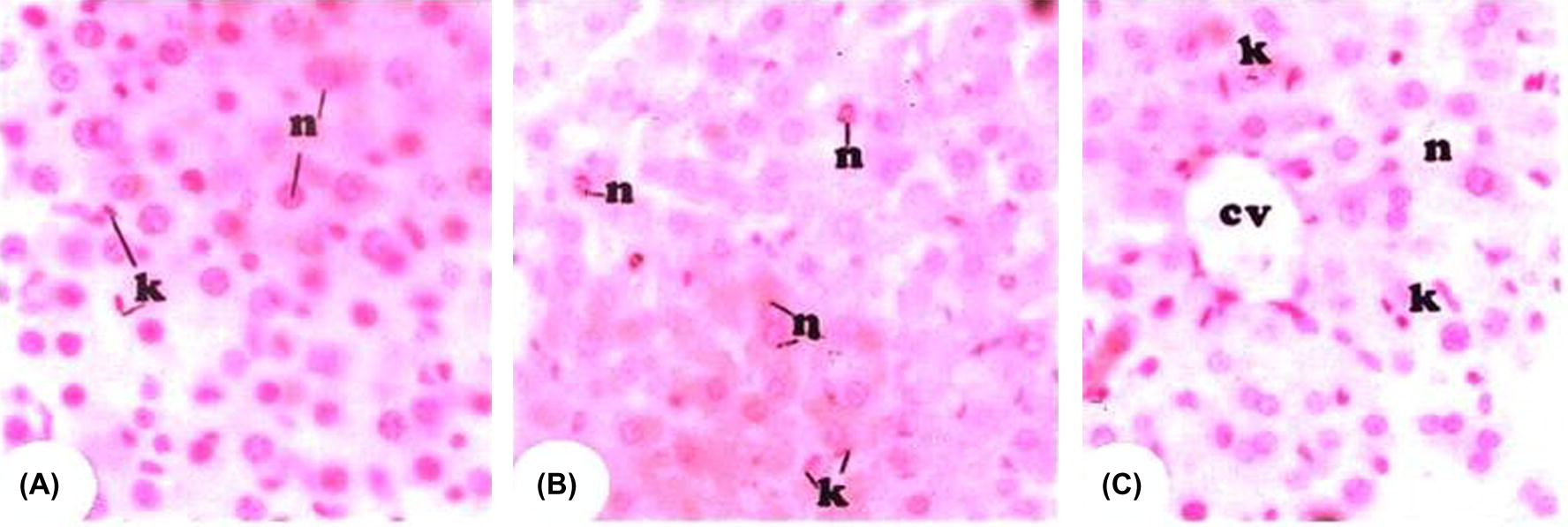 Photomicrograph of Feulgen reaction for nuclear DNA detection in the liver sections from all groups (A) represent photomicrograph from control group displaying an intensive reaction for DNA in the nuclei (n). Kuppfer cells (k) are distinct. (B) Represents photomicrograph from Cr-treated rat showing great depletion of DNA stained materials in the nuclei (n) of the hepatocytes. Kupffer cells (k) are markedly increased. (C) Represents: photomicrograph from Cr + vitamin E-treated rats showing the great restoration of the DNA in the nuclei (n) of the heptocytes. Kupffer cells (k) are still numerous.