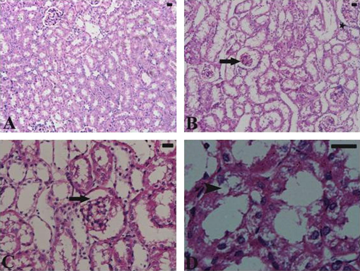 (A) Untreated control kidney shows normal architecture. (B–D) Histological changes in the renal tissue of mice treated with N. haje crude venom. Treated kidney of mice appeared with moderate inflammatory cellular infiltration (star). Some kidney tubules are vacuolated (arrow head). Most of the glomeruli appeared shrunken (arrow). Sections were stained with hematoxylin and eosin. Bar = 25 μm.