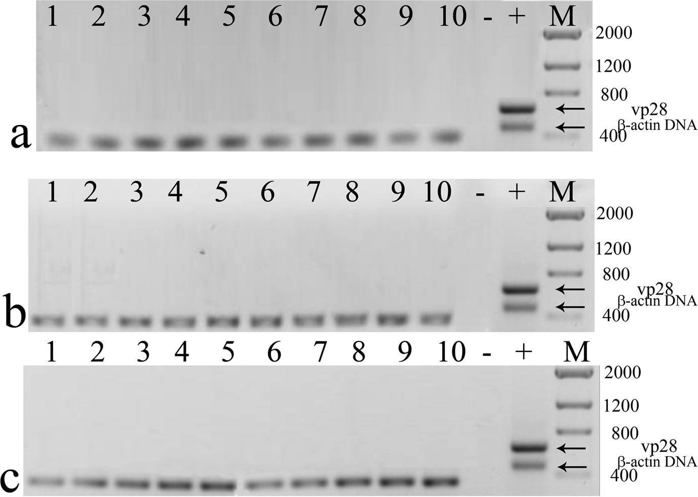 RT-PCR from surviving shrimp treated with dsRNA against (a) vp28, (b) orf89, (c) vp26. No vp28 cDNA amplification was observed. Amplification of shrimp β-actin cDNA was done as internal control. Size of β-actin cDNA was slightly lower than β-actin DNA (≈330 bp). Negative control (−), WSSV positive control (+), molecular weight marker (M) size in base pairs.