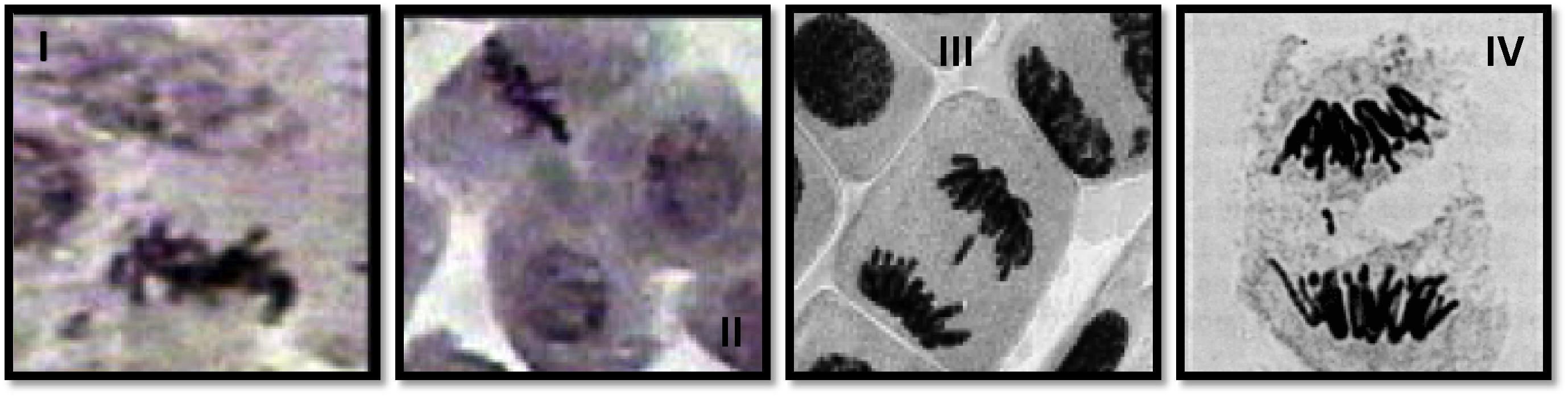 I. Sticky chromosome, II. Precocious separation, III. Anaphase with Laggard, IV. Anaphase with fragment.