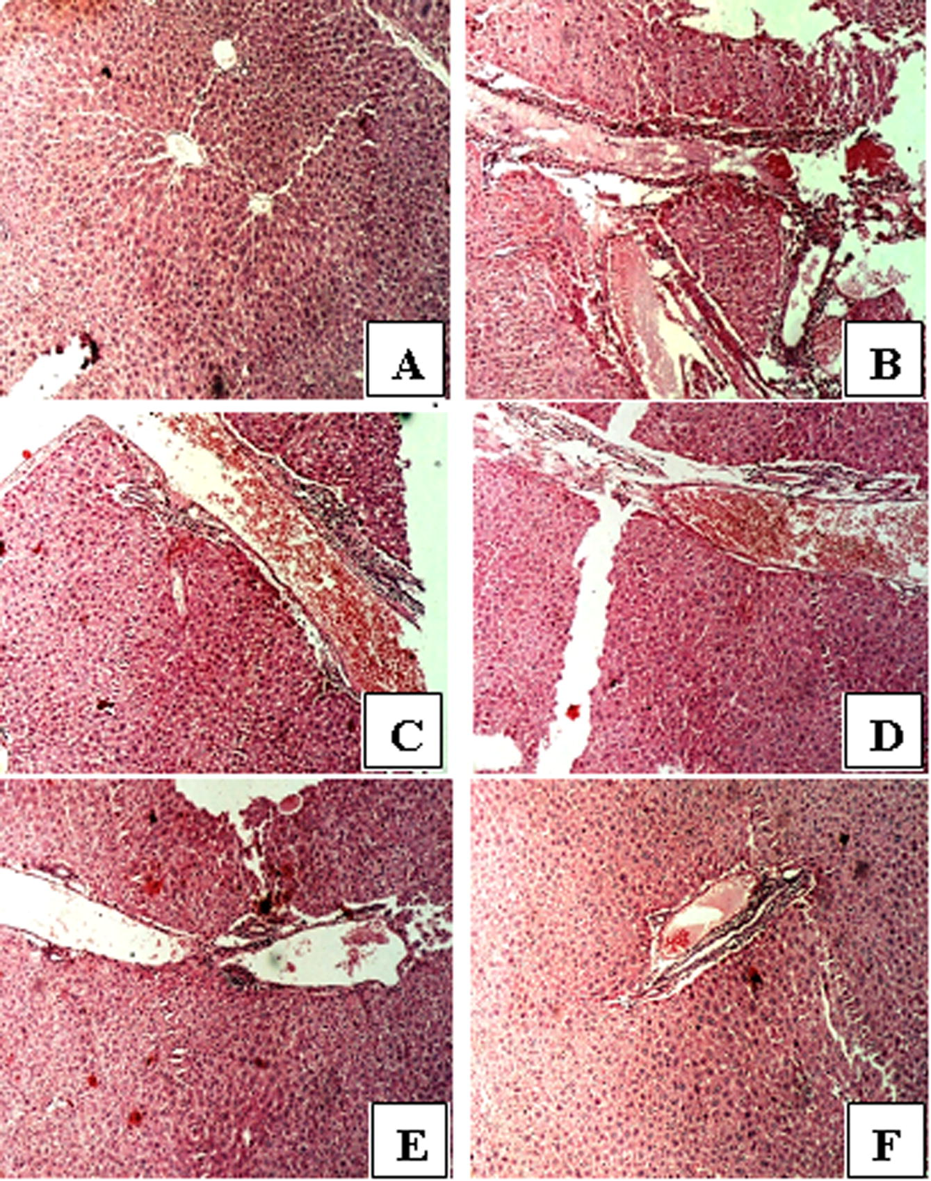 Histopathological analysis of BALB/c mice liver treated with S. sclarea essential oil. (A) Normal control representing no obvious abnormality of inflammation. (B) Positive control (1.5 μg/mL LPS) representing abnormality of inflammation. (C) The tissue exhibited severe necrosis with inflammation at 25 μg/mL of oil. (D) The histology of the hepatocytes observed to be slightly altered with mild inflammation and cellular necrosis at 50 μg/mL of oil. (E) The hepatocytes appear normal with very mild necrosis observed at 75 μg/mL oil. (F) No obvious abnormality at 100 μg/mL of oil.