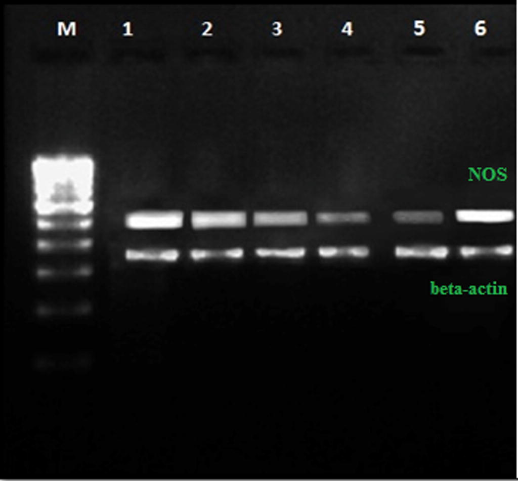 Efficacy of S. sclarea essential oil on down regulation of iNOS. (M) 100 bp DNA ladder, (1) positive control (LPS at 1.5 μg/mL), (2) (3) (4) and (5) iNOS down regulation activity of oil at 25, 50, 75 and 100 μg/mL respectively, (6) normal control (NOS gene).