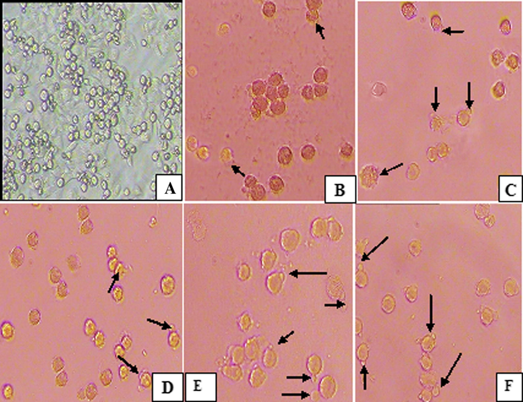 Apoptotic activity of S. sclarea essential oil on HeLa cells. (A) Control, (B) (C) (D) (E) and (F) apoptotic induction of oil at a concentration of 25, 50, 75, 100 and 125 μg/mL, respectively.