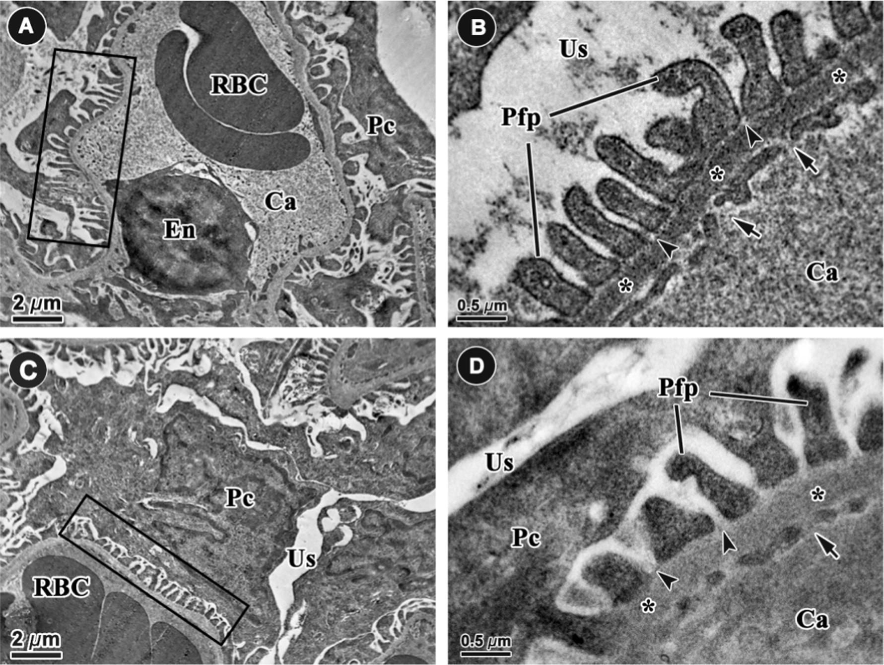 Representative electron microscope micrographs of the glomerular filtration barrier in the control (A and B) and food restricted offspring (C and D) at 6000× and 60,000× at six months of age (n = 8 per group). The podocyte foot processes (rectangles, Pfp) were shorter and thicker in FR offspring than in control offspring. The filtration slits (arrow heads) and glomerular capillary endothelial fenestrae (arrows) were wider in FR animals than controls. The thickness of the basement membrane (*) was increased in FR offspring compared to controls. Ca: capillary, En: endothelial cell, Pc: podocyte, RBC: red blood cell, Us: urinary space.