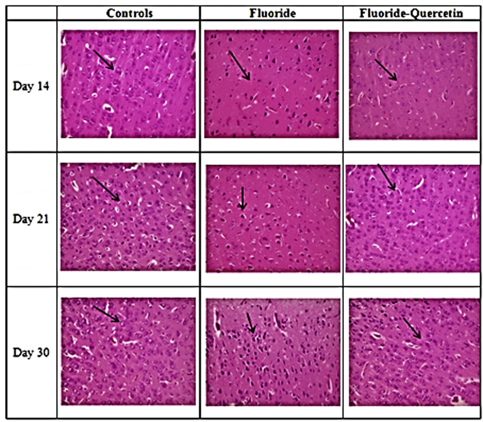 Effect of quercetin on the histological alterations induced on chronic exposure of NaF in the cerebral cortex of 14, 21 and 30 days old rat pups (40X).