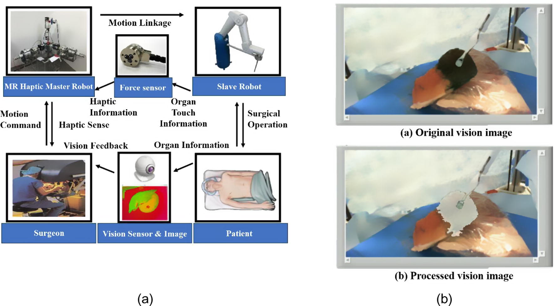 A robot-assisted surgery diagram using the MR haptic master (Choi et al., 2015); (a) surgery diagram, (b) original and processed images.